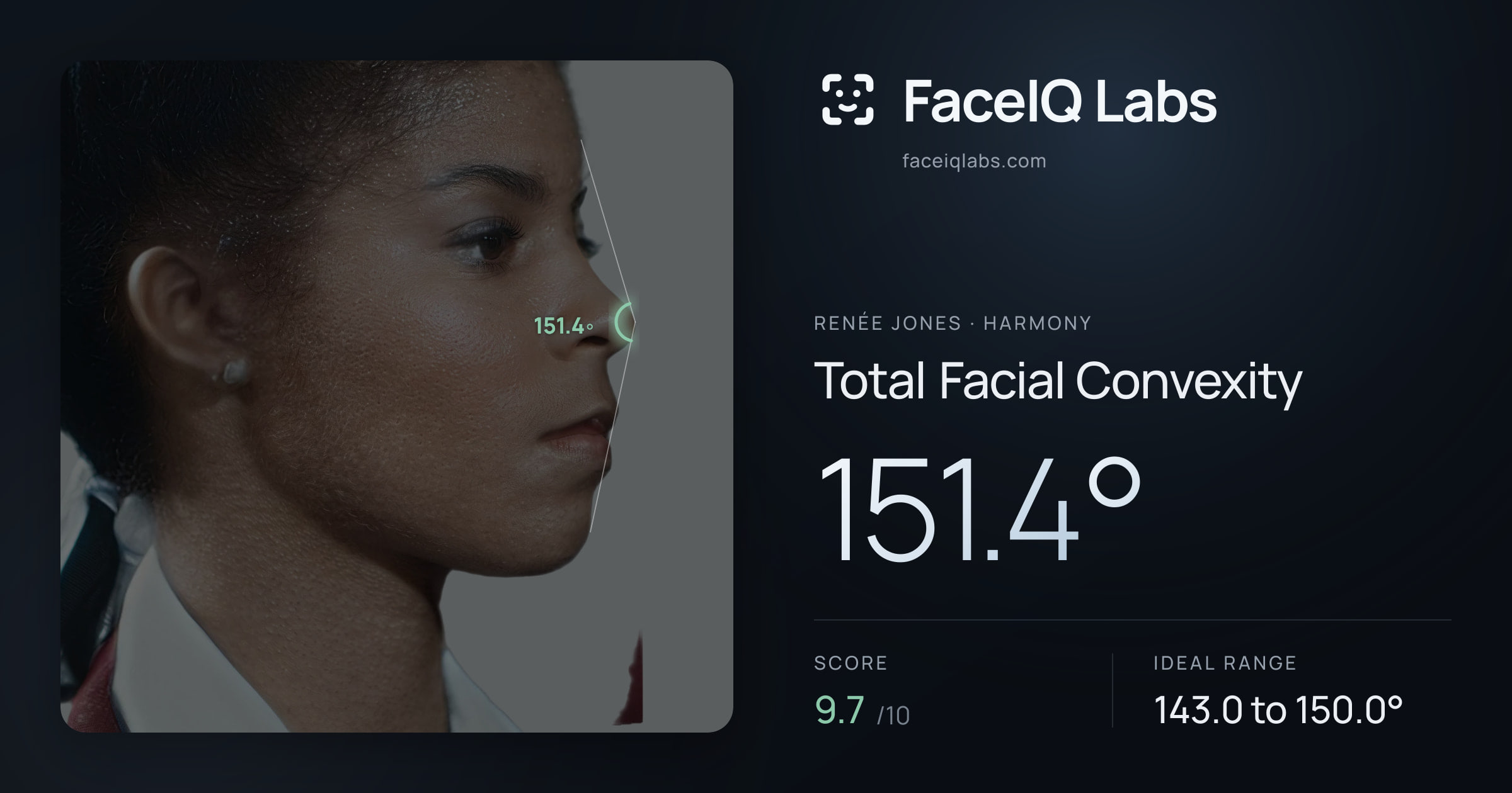 Renée Jones Total Facial Convexity: 151.4°, drawn on the photo