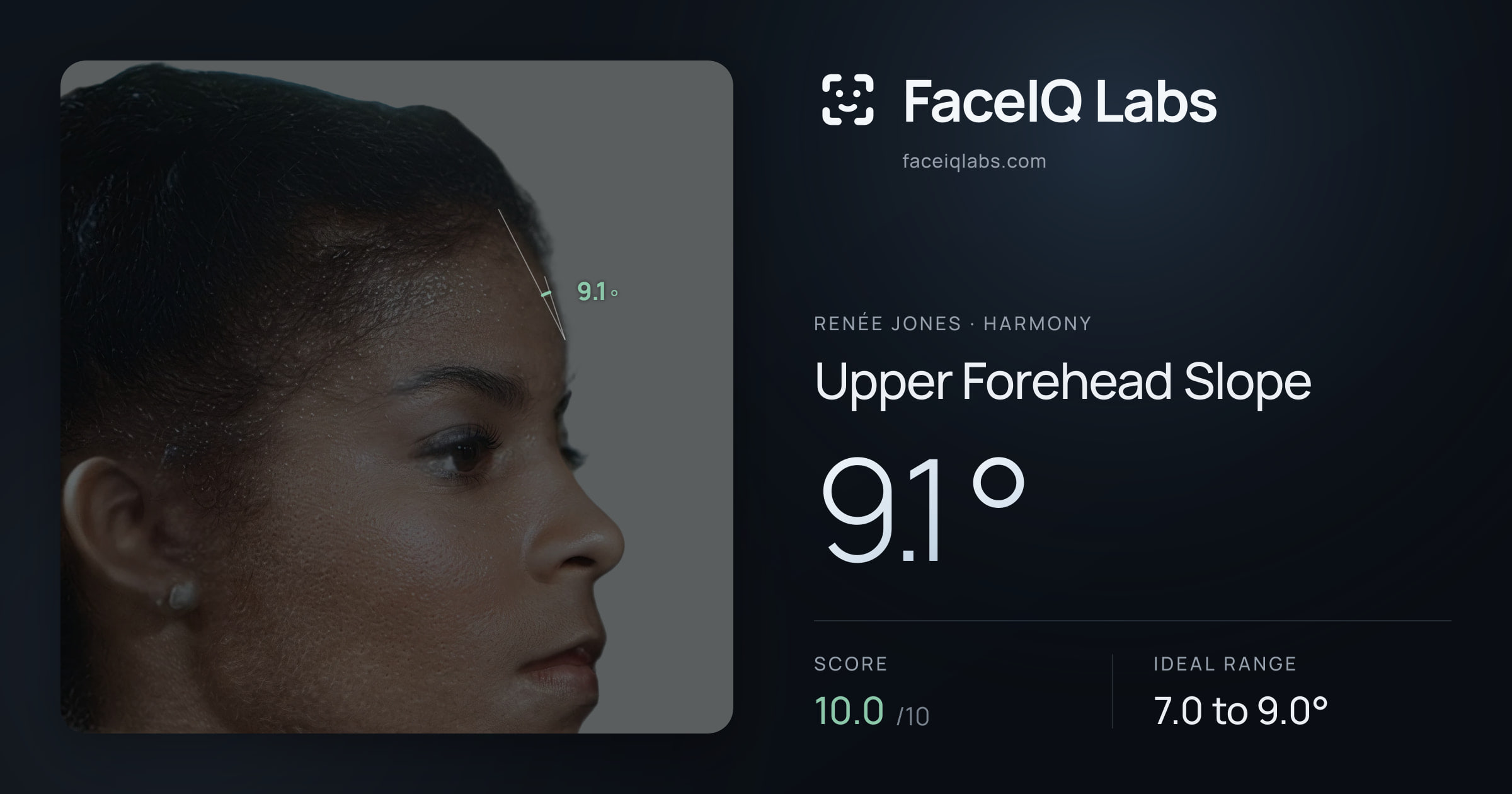 Renée Jones Upper Forehead Slope: 9.1°, drawn on the photo
