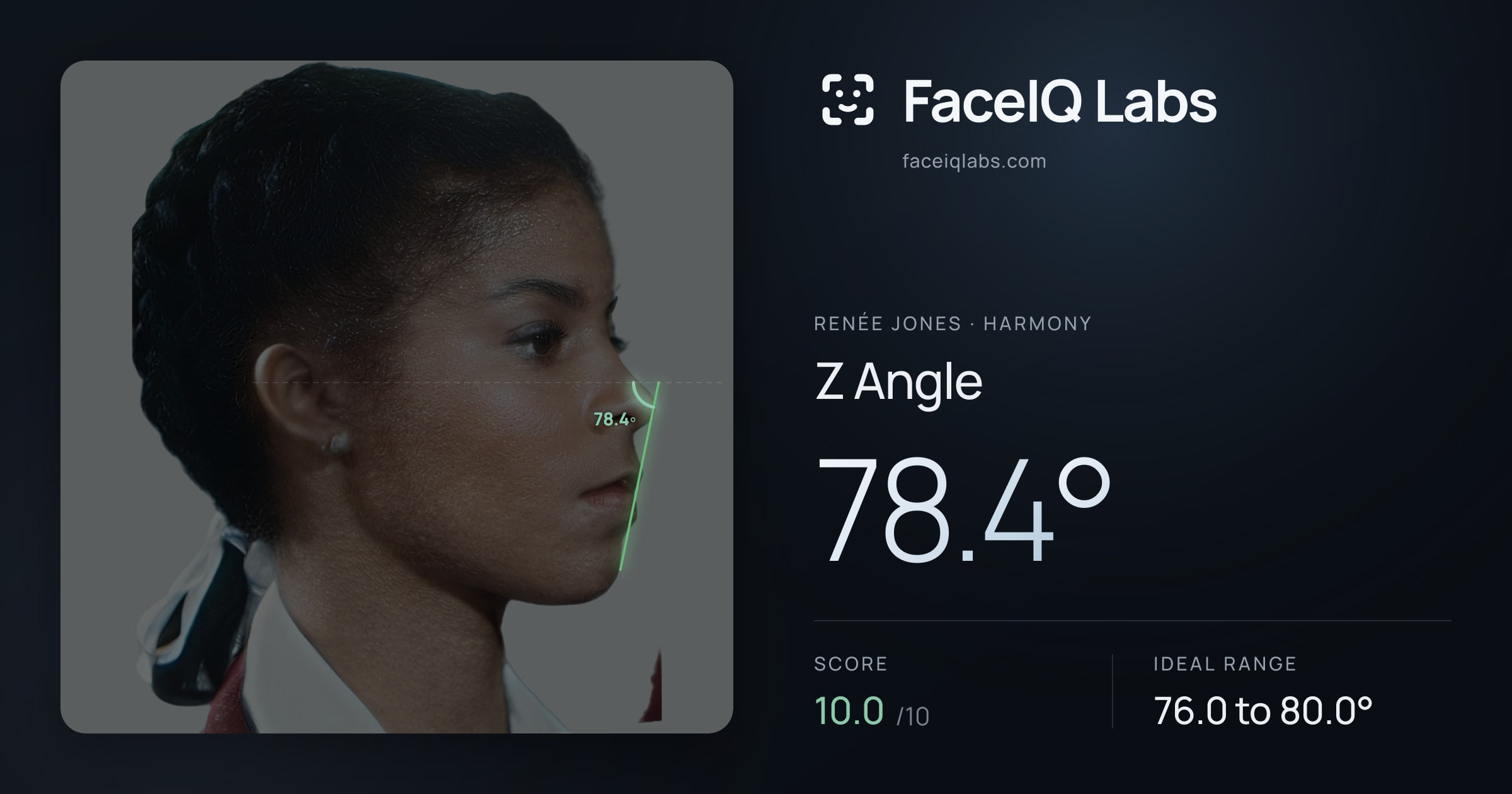 Renée Jones Z Angle: 78.4°, drawn on the photo