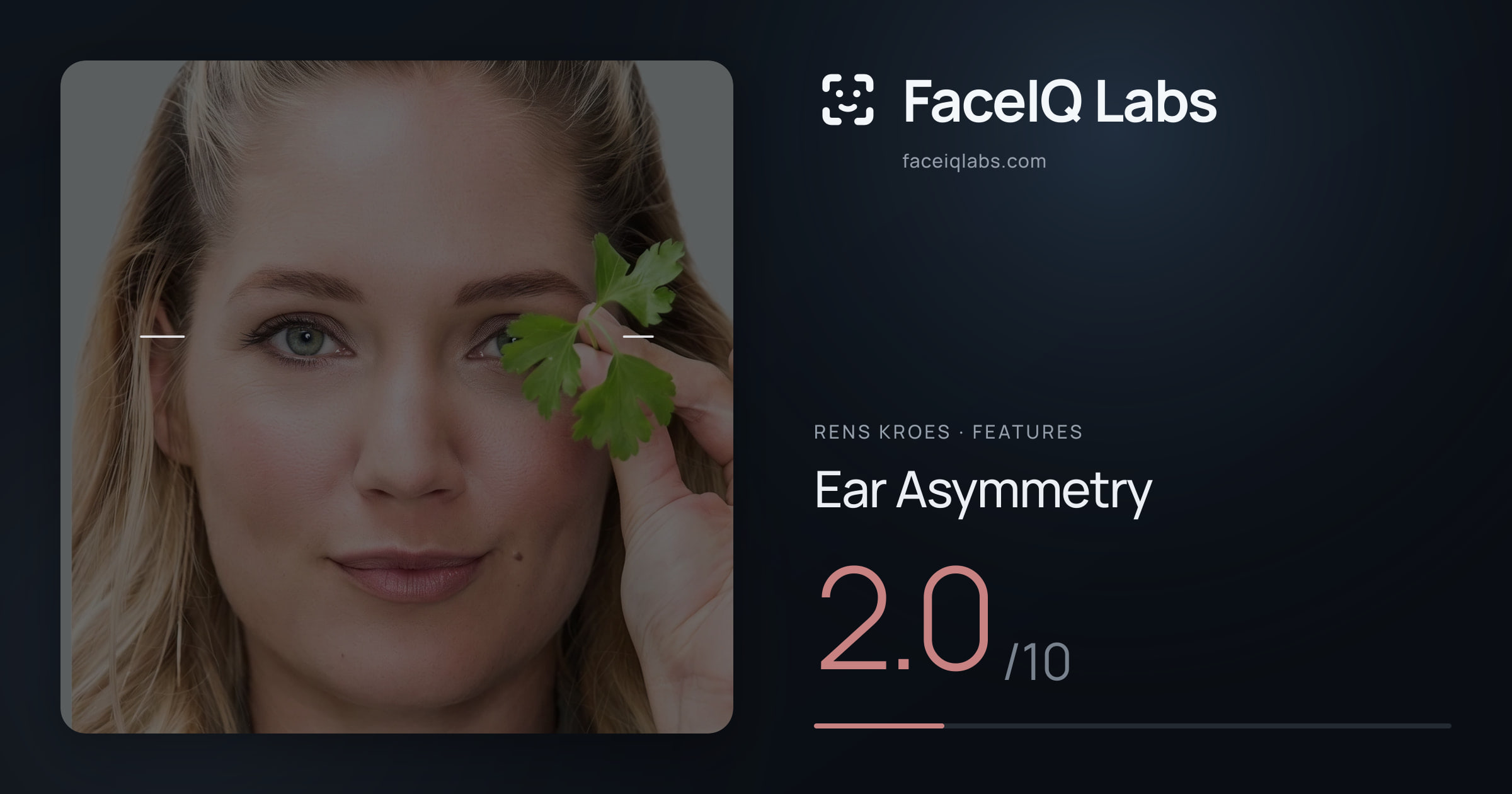 Rens Kroes Ear Asymmetry: 2.0/10, drawn on the photo