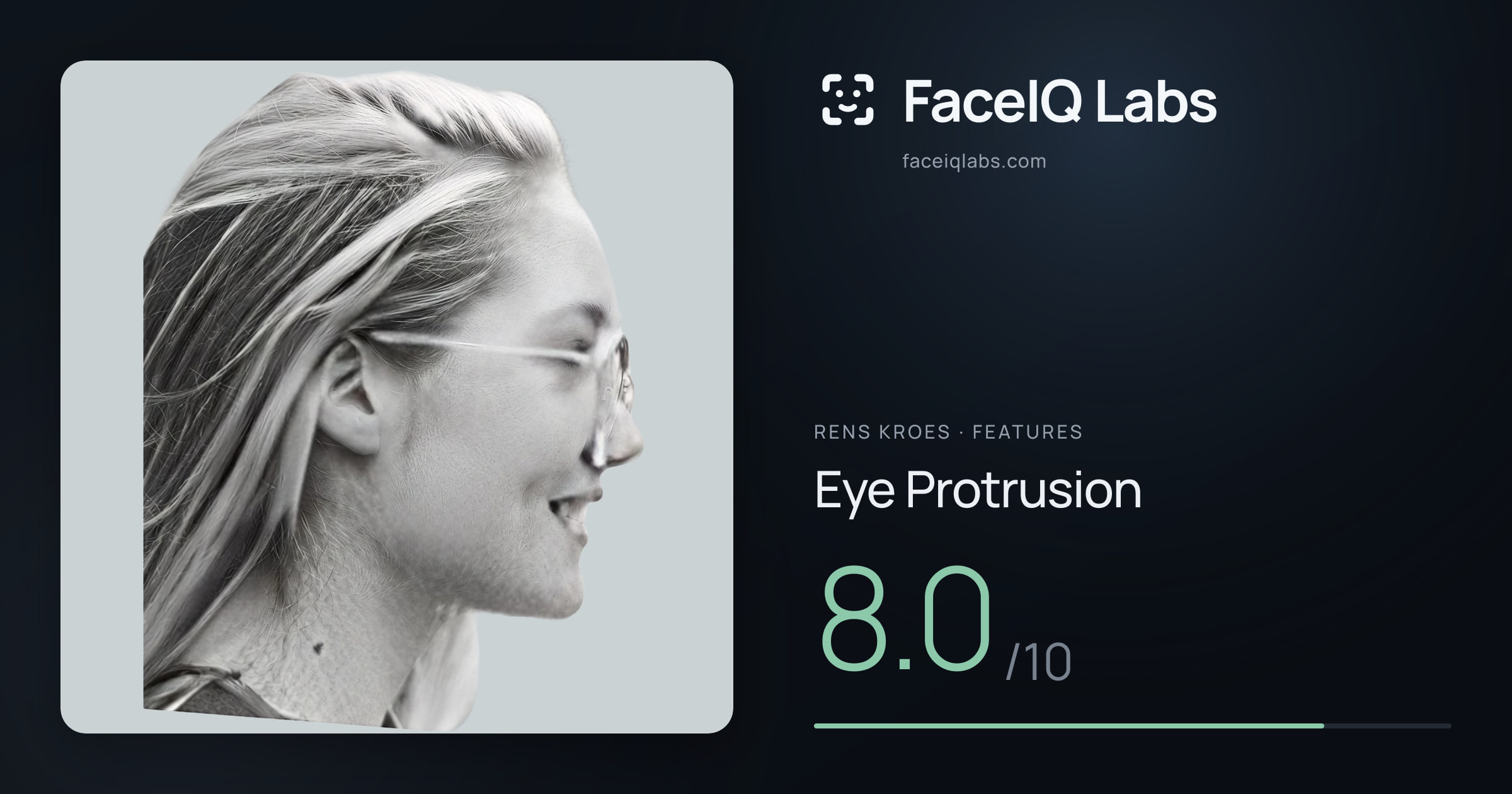 Rens Kroes Eye Protrusion: 8.0/10, drawn on the photo