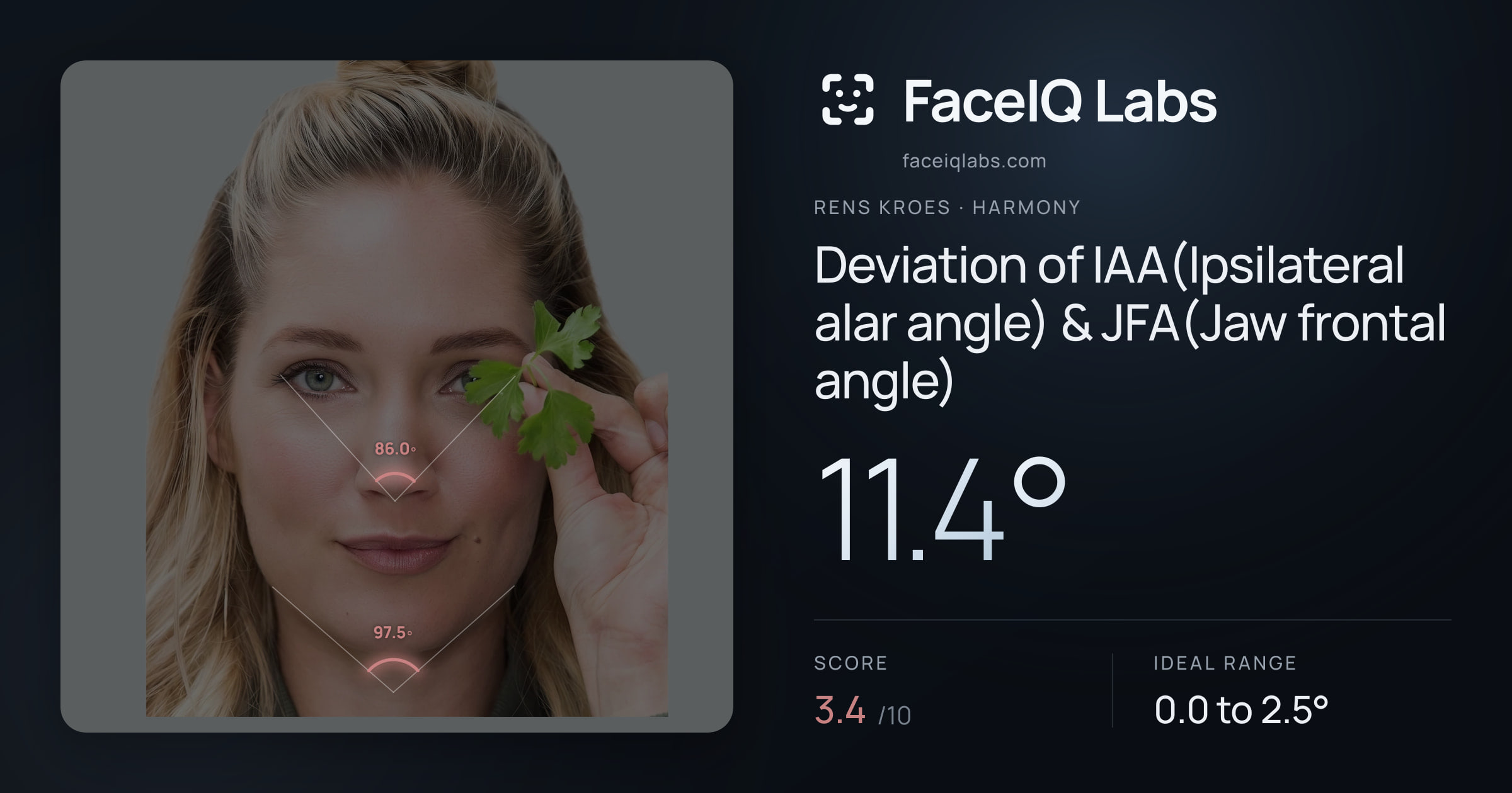 Rens Kroes Deviation of IAA(Ipsilateral alar angle) & JFA(Jaw frontal angle): 11.4°, drawn on the photo