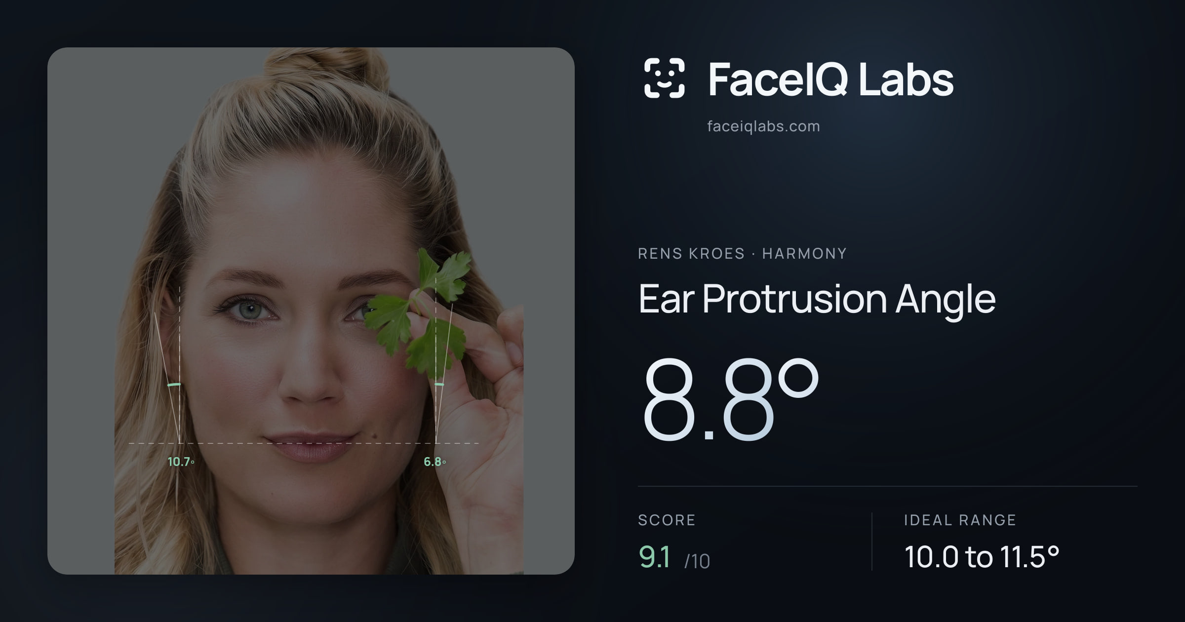 Rens Kroes Ear Protrusion Angle: 8.8°, drawn on the photo