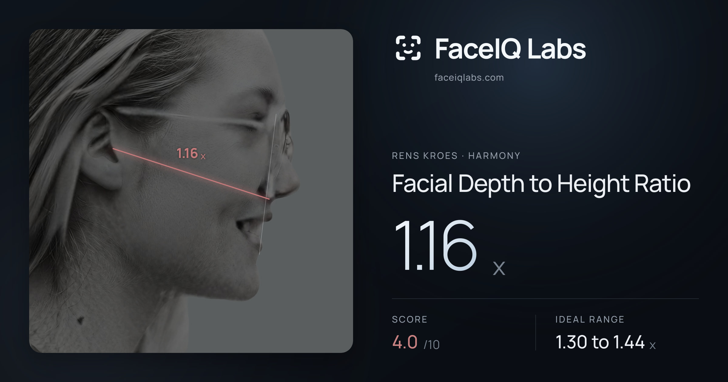Rens Kroes Facial Depth to Height Ratio: 1.16x, drawn on the photo