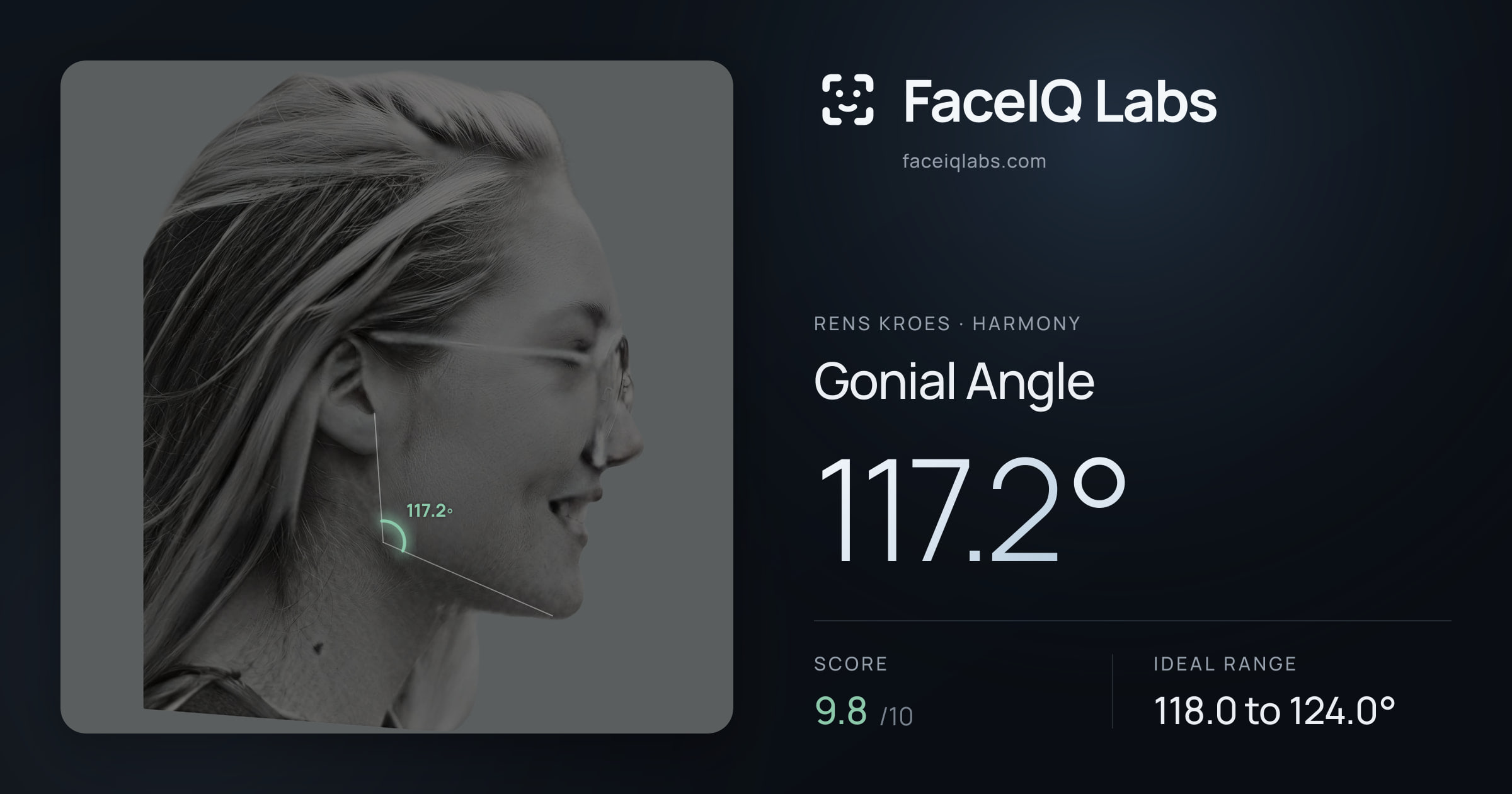 Rens Kroes Gonial Angle: 117.2°, drawn on the photo