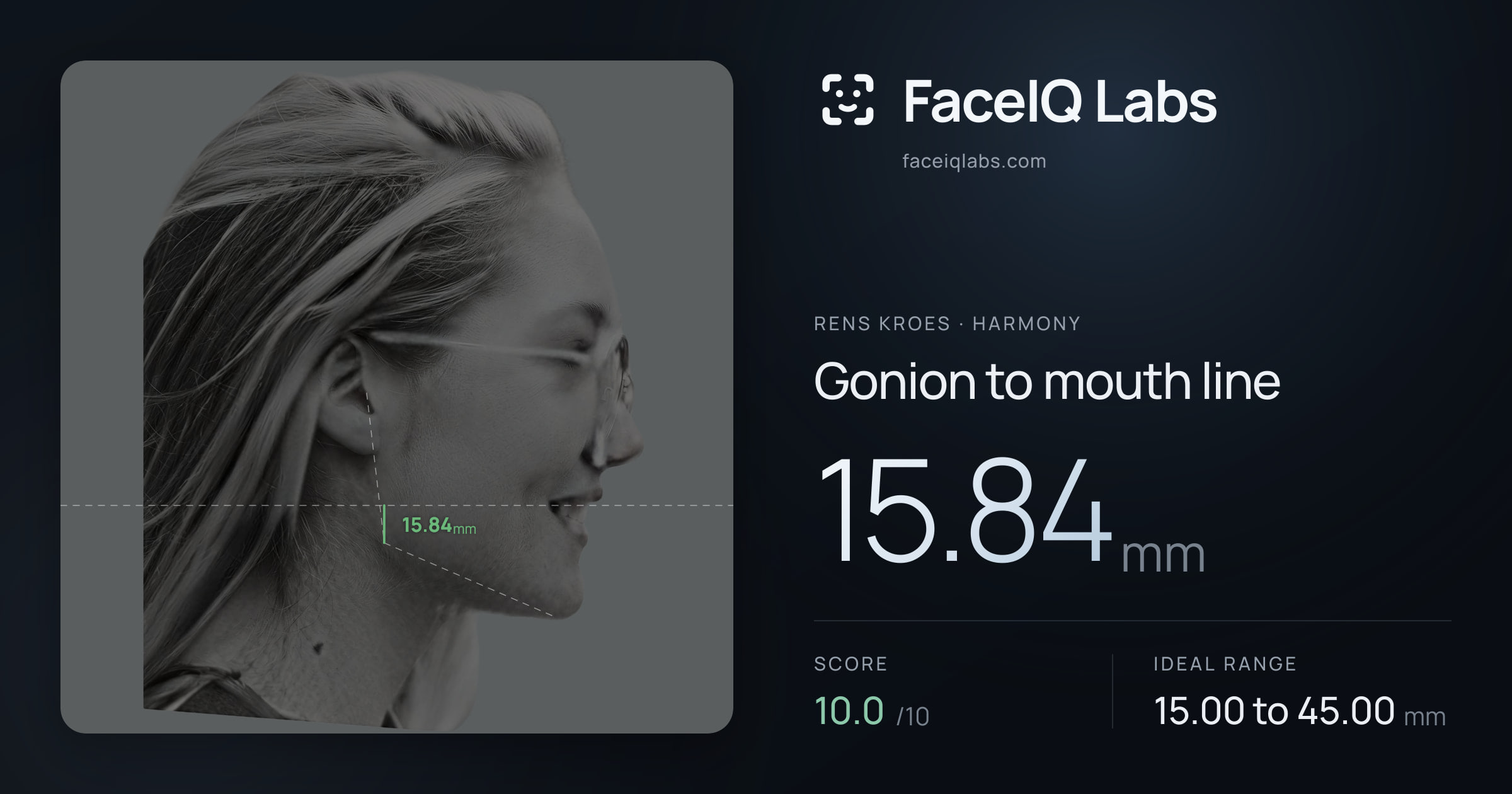 Rens Kroes Gonion to mouth line: 15.84mm, drawn on the photo