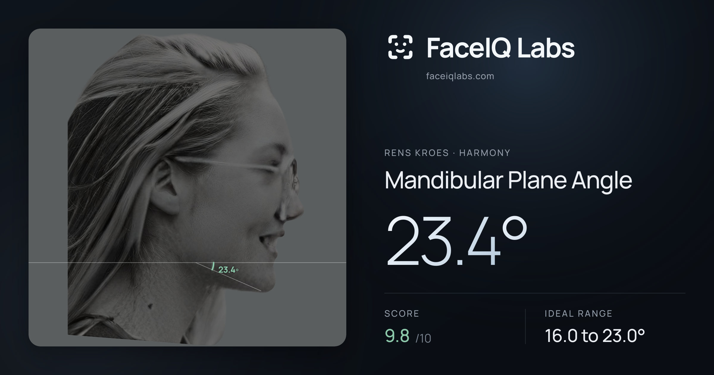 Rens Kroes Mandibular Plane Angle: 23.4°, drawn on the photo