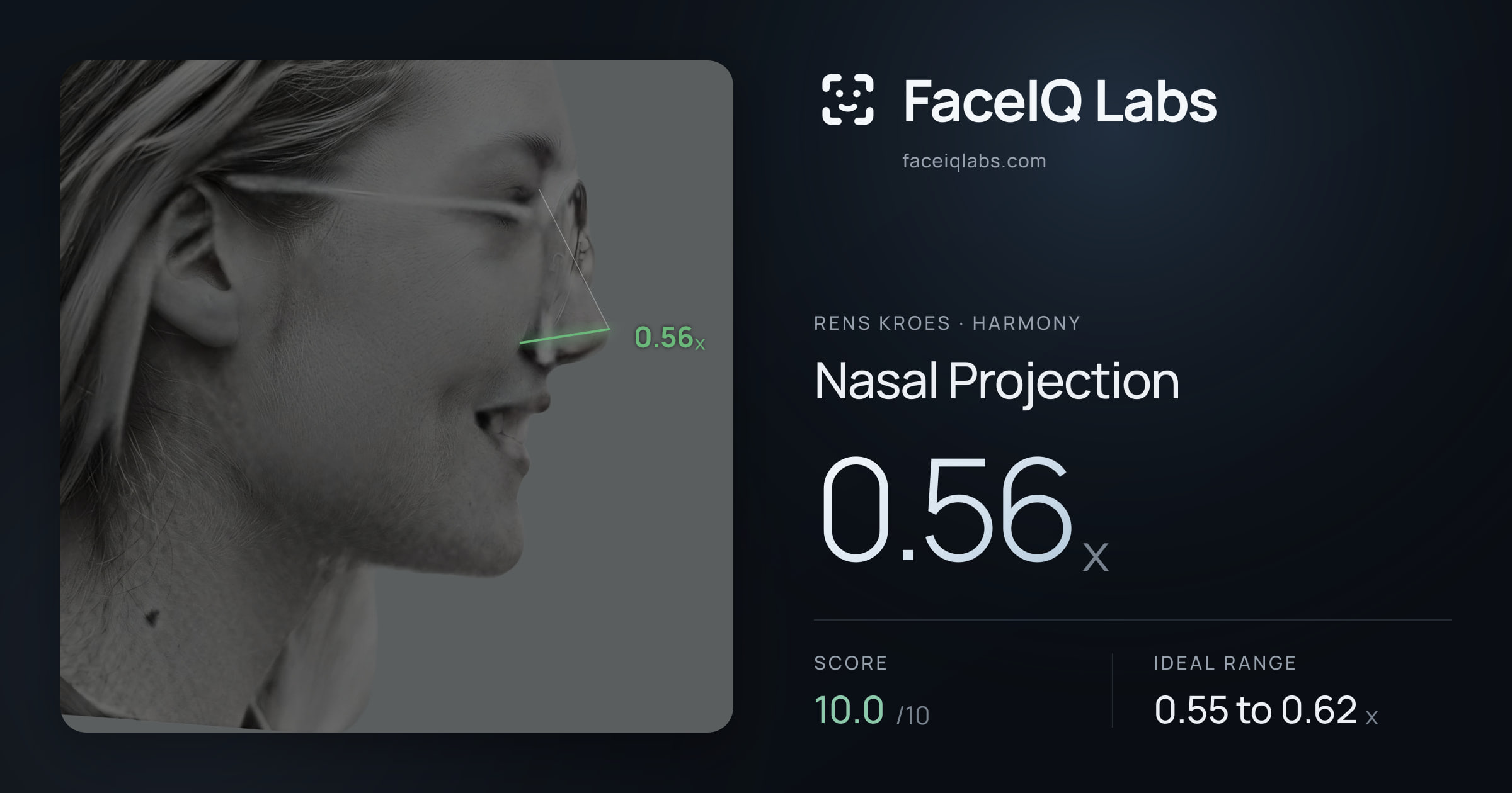 Rens Kroes Nasal Projection: 0.56x, drawn on the photo