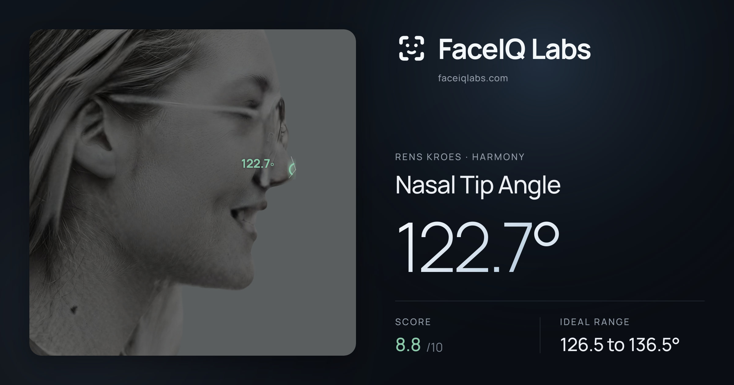 Rens Kroes Nasal Tip Angle: 122.7°, drawn on the photo