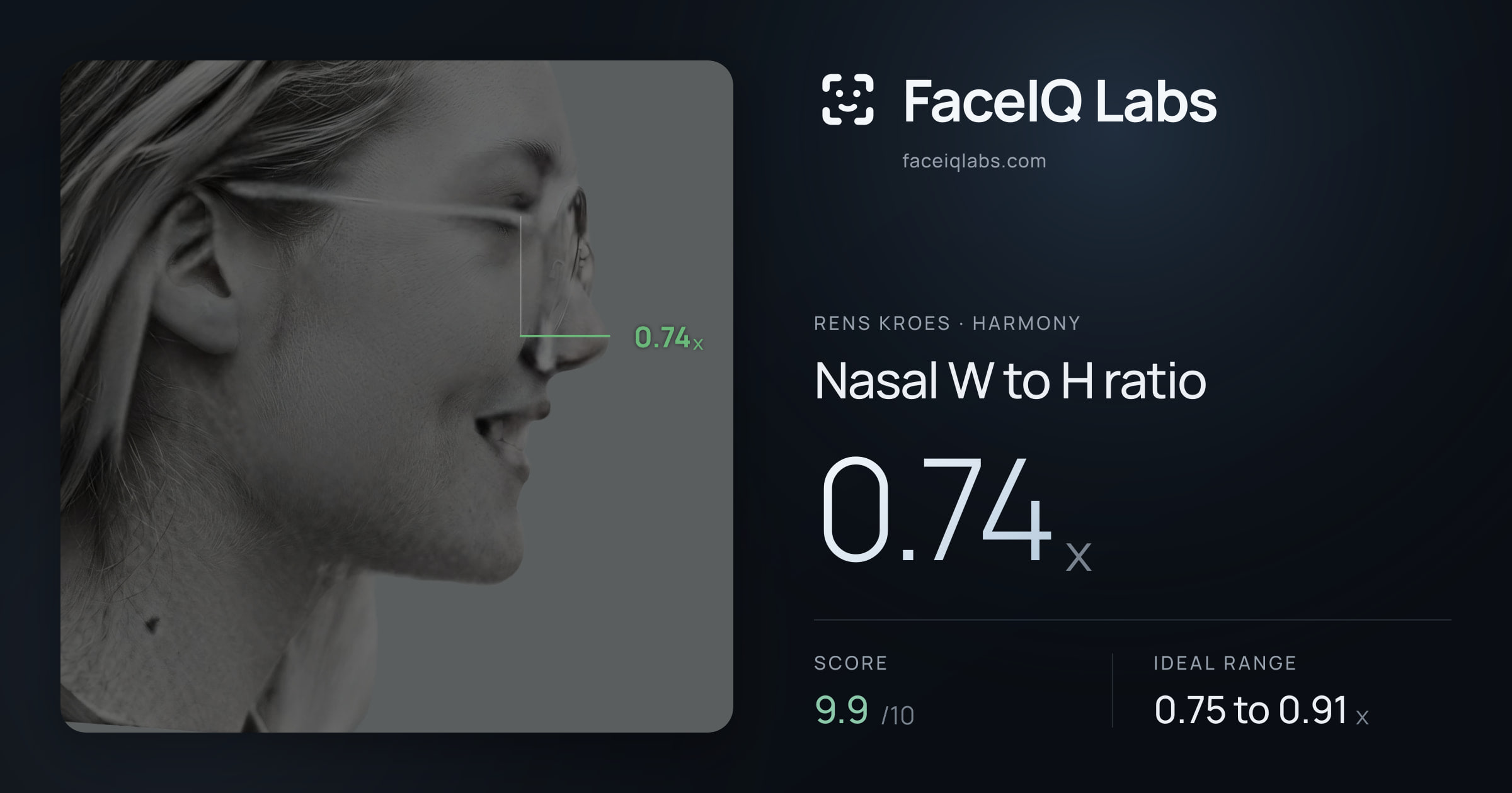 Rens Kroes Nasal W to H ratio: 0.74x, drawn on the photo