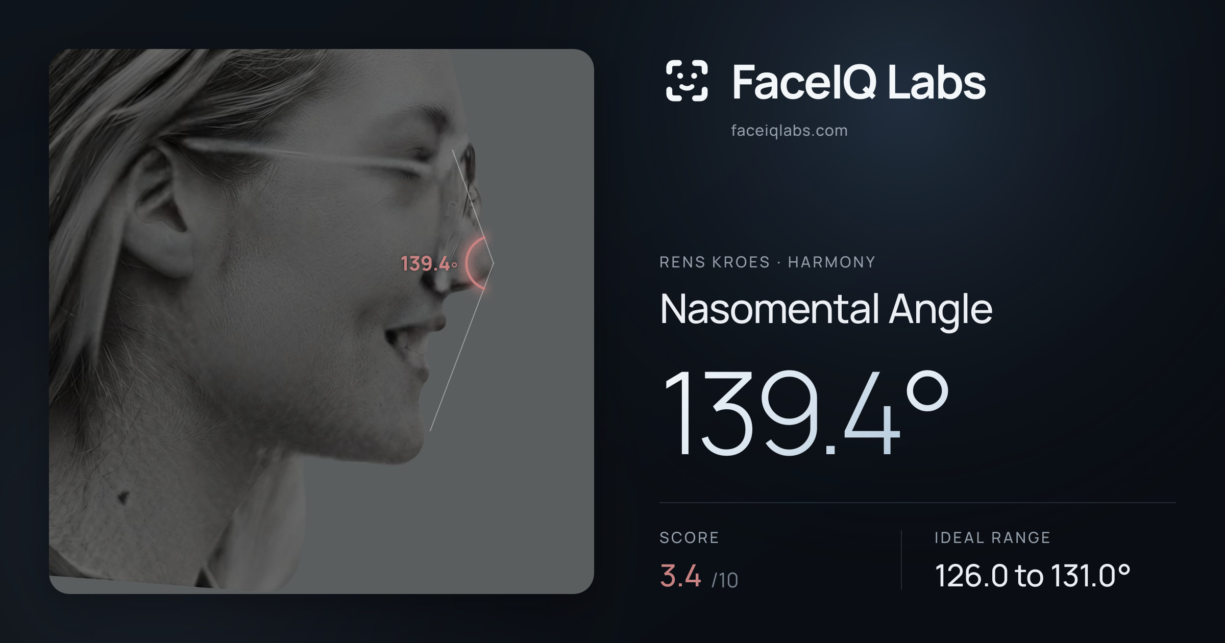 Rens Kroes Nasomental Angle: 139.4°, drawn on the photo