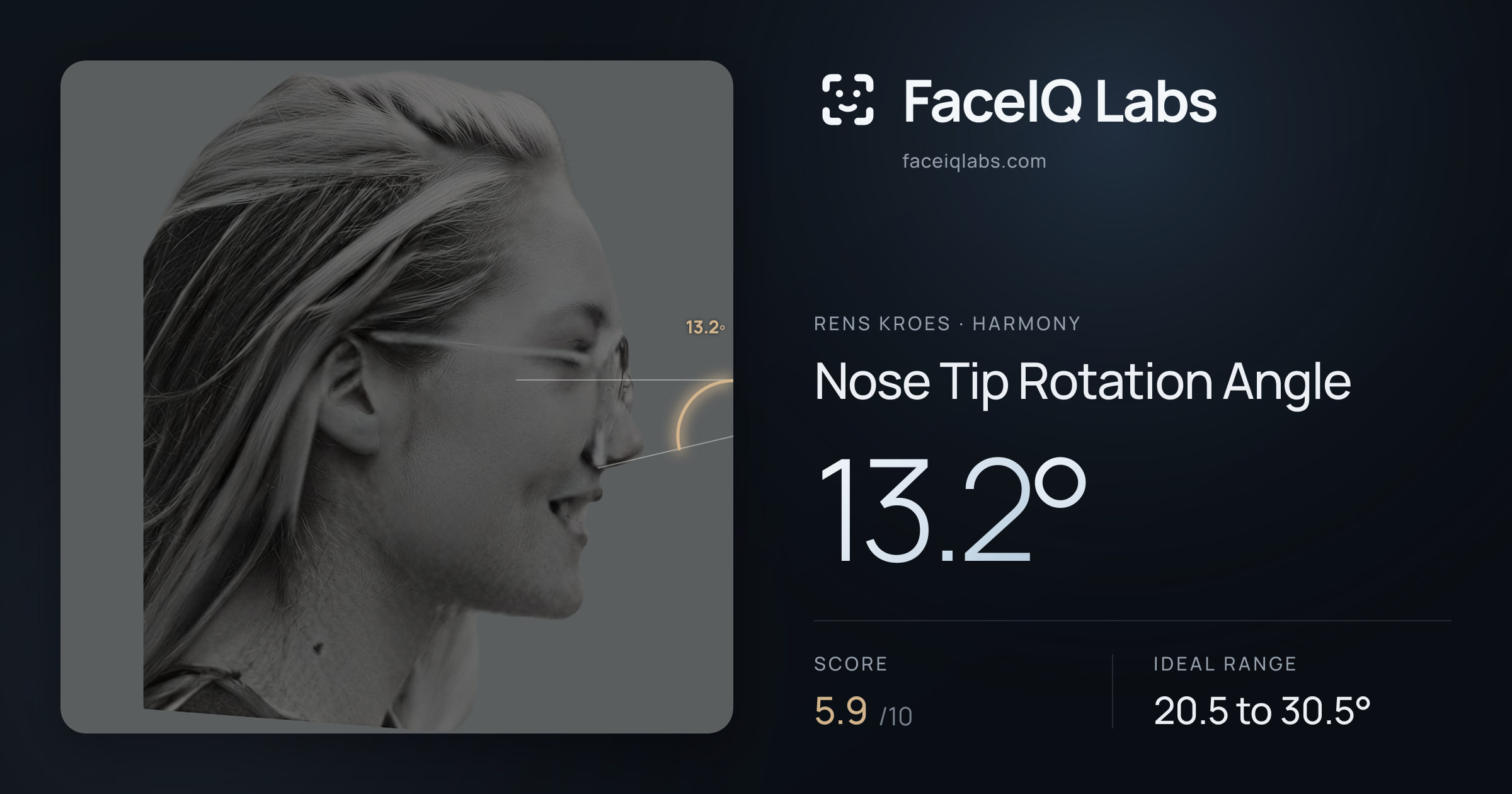 Rens Kroes Nose Tip Rotation Angle: 13.2°, drawn on the photo