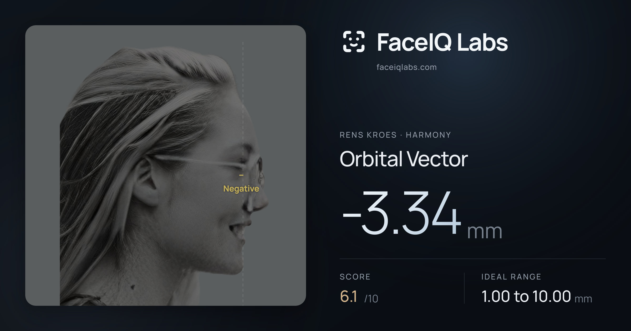 Rens Kroes Orbital Vector: -3.34mm, drawn on the photo