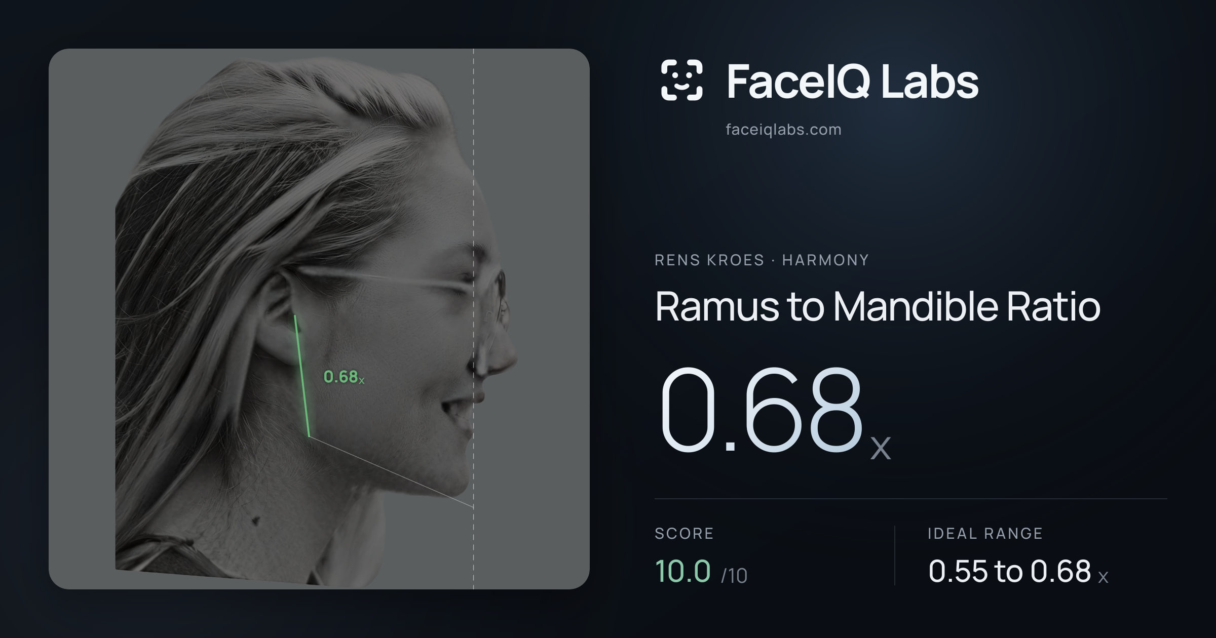 Rens Kroes Ramus to Mandible Ratio: 0.68x, drawn on the photo