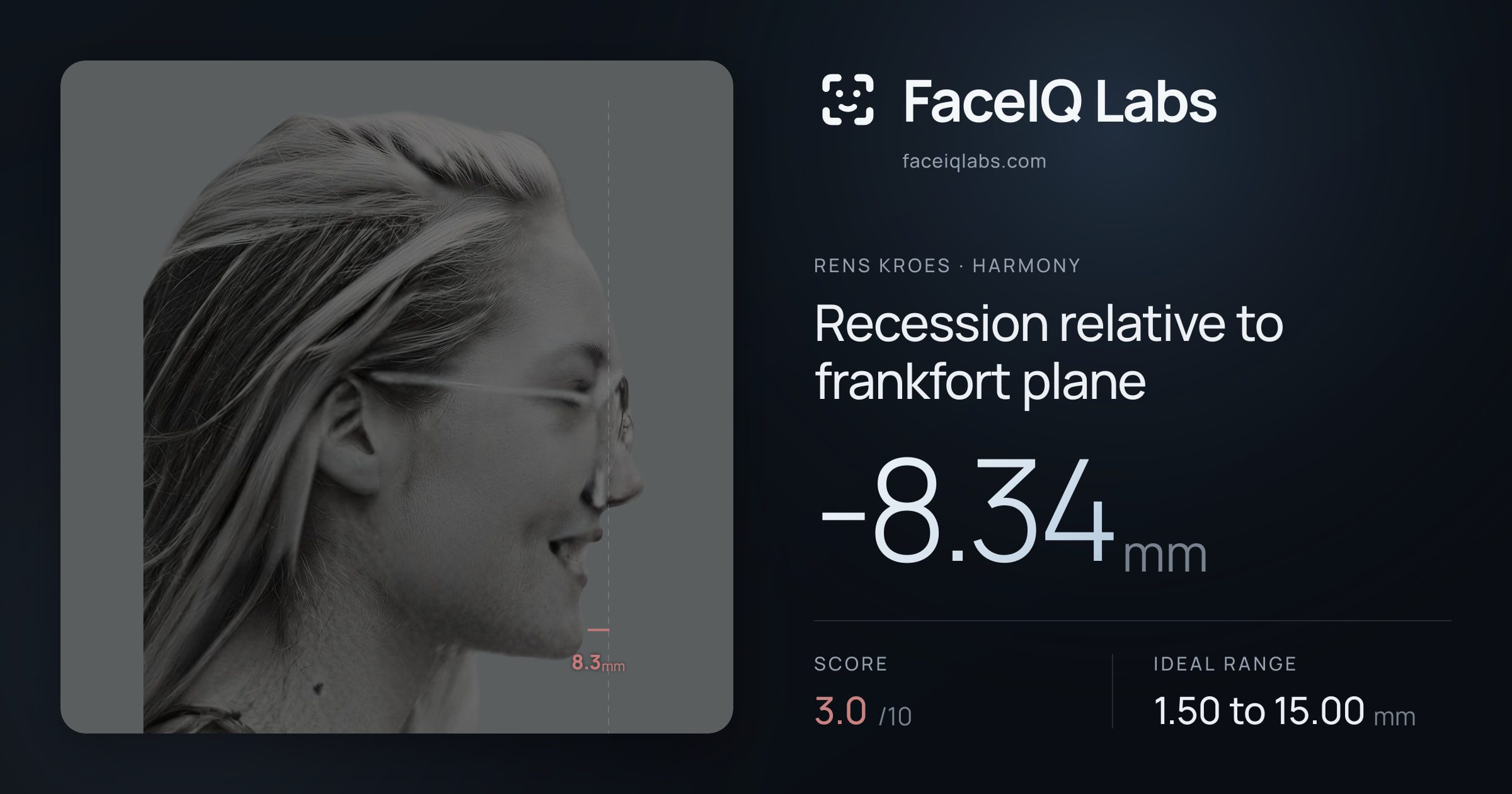 Rens Kroes Recession relative to frankfort plane: -8.34mm, drawn on the photo