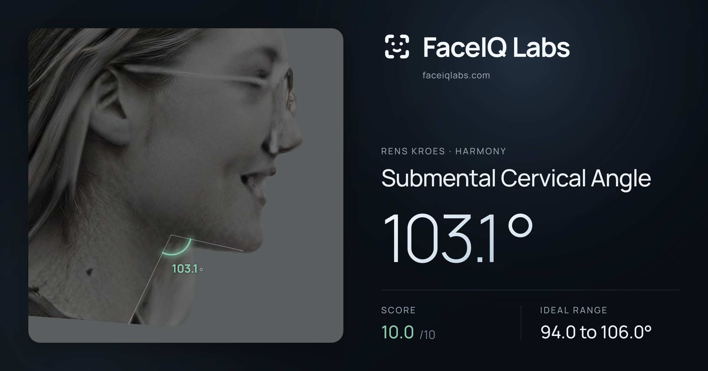 Rens Kroes Submental Cervical Angle: 103.1°, drawn on the photo