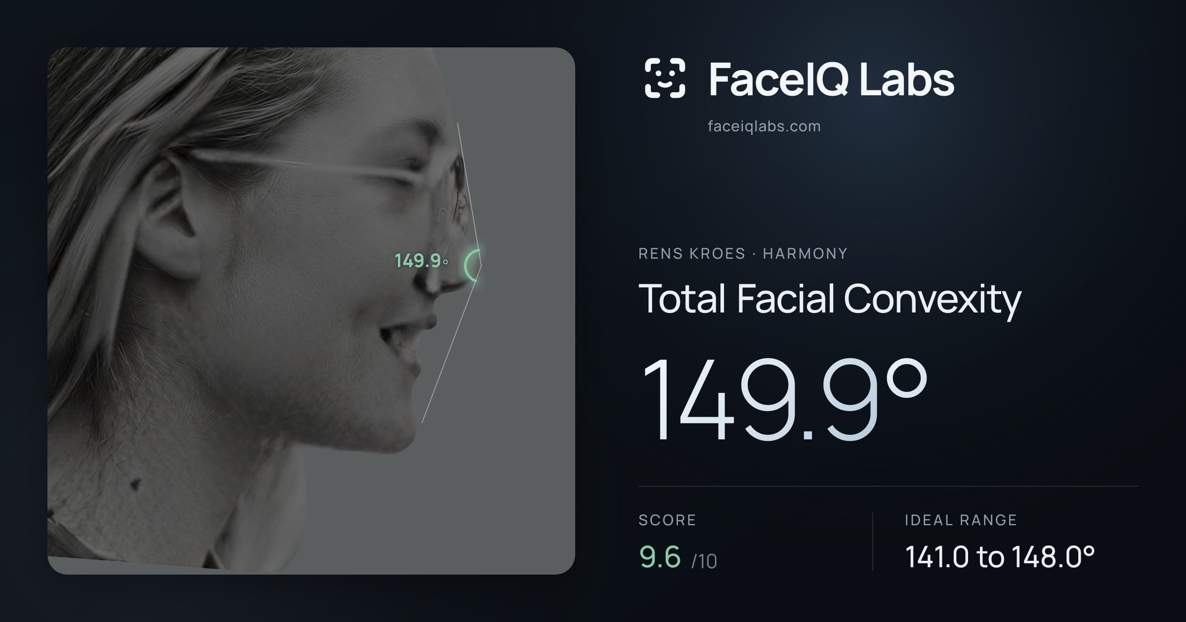 Rens Kroes Total Facial Convexity: 149.9°, drawn on the photo
