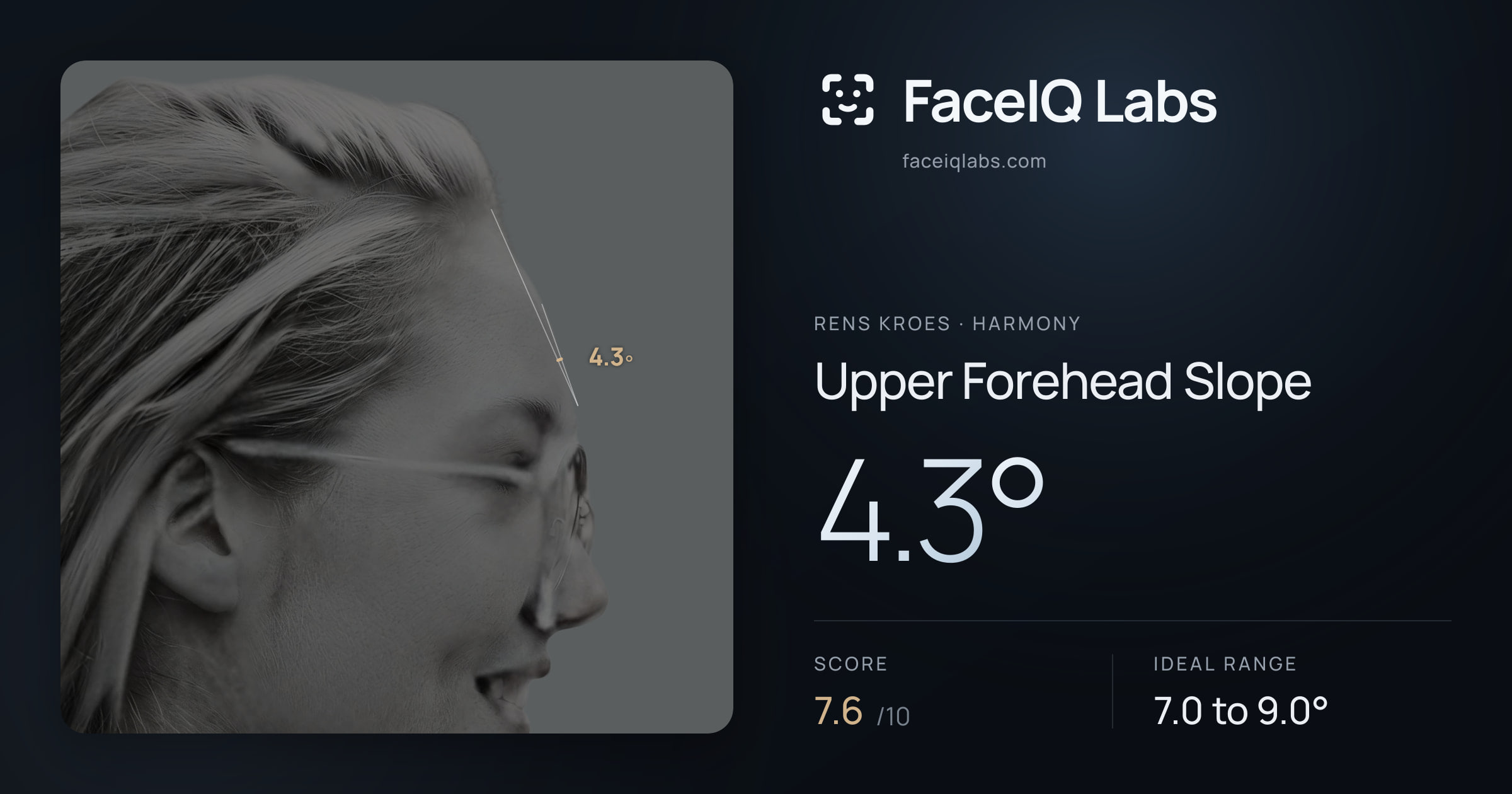 Rens Kroes Upper Forehead Slope: 4.3°, drawn on the photo