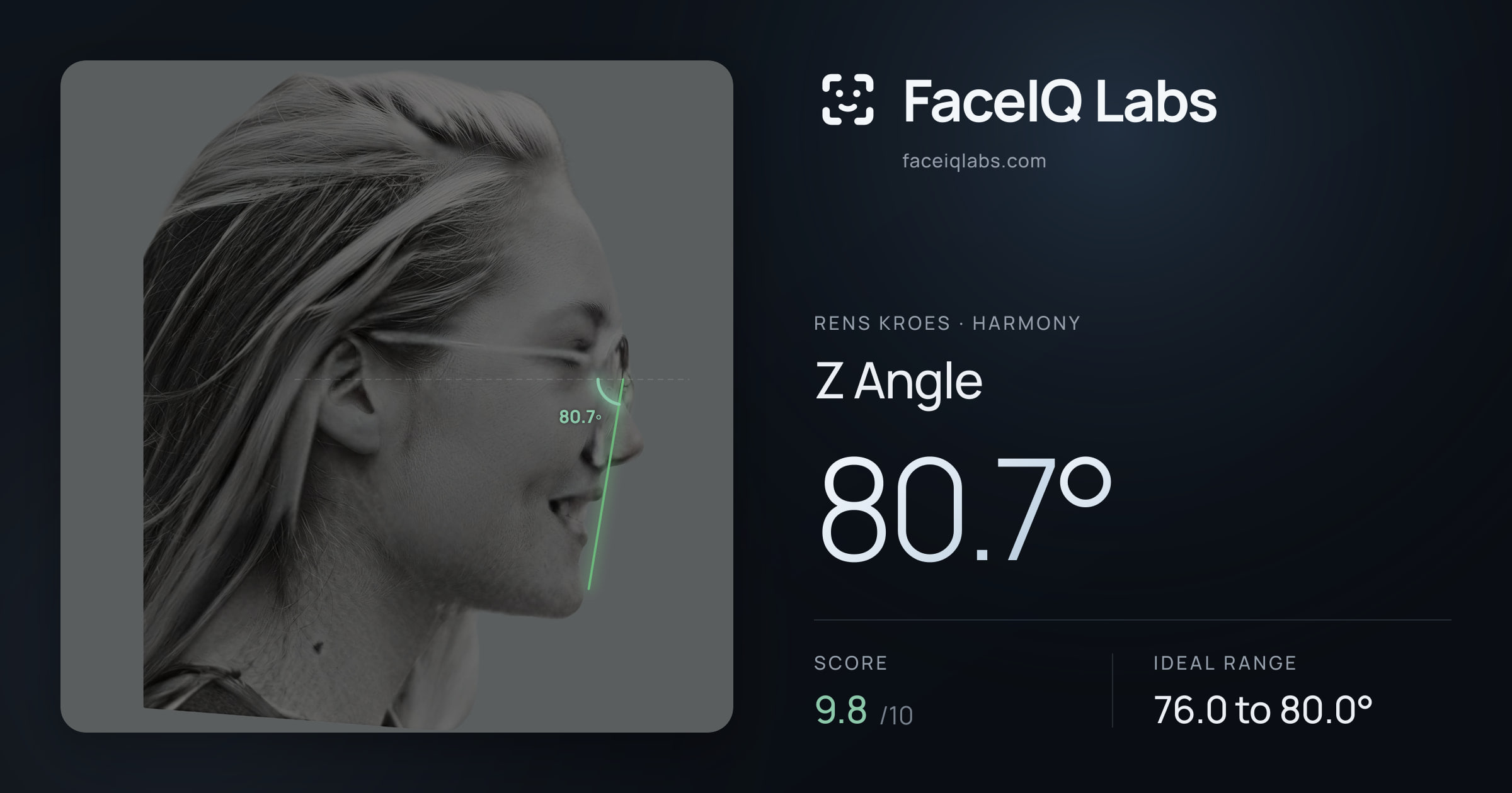 Rens Kroes Z Angle: 80.7°, drawn on the photo
