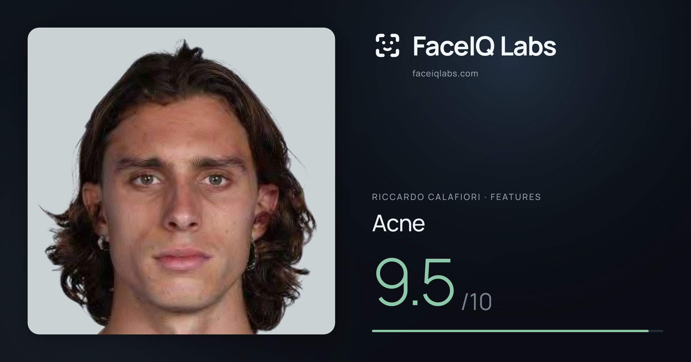 Riccardo Calafiori Acne: 9.5/10, drawn on the photo