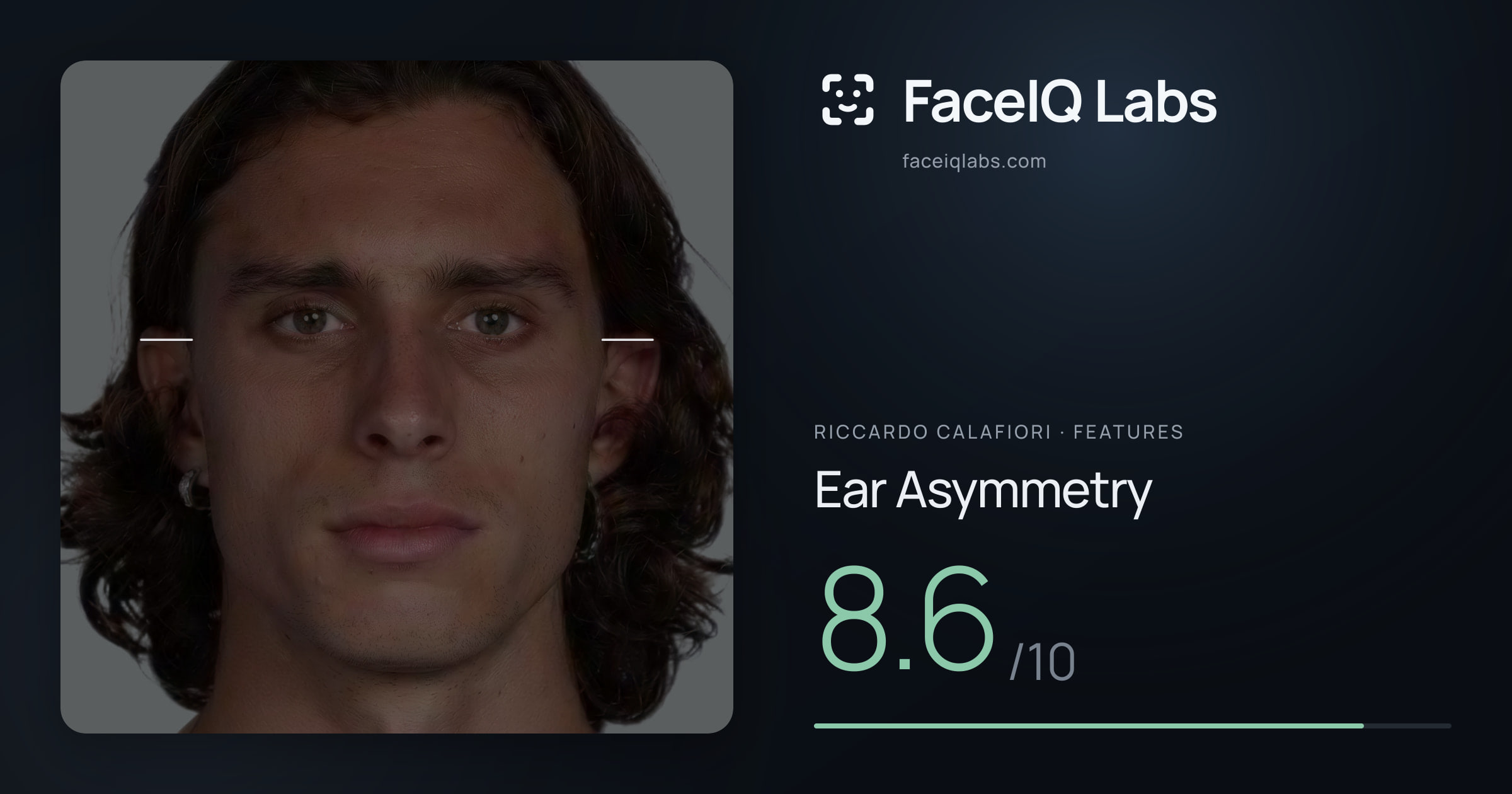 Riccardo Calafiori Ear Asymmetry: 8.6/10, drawn on the photo
