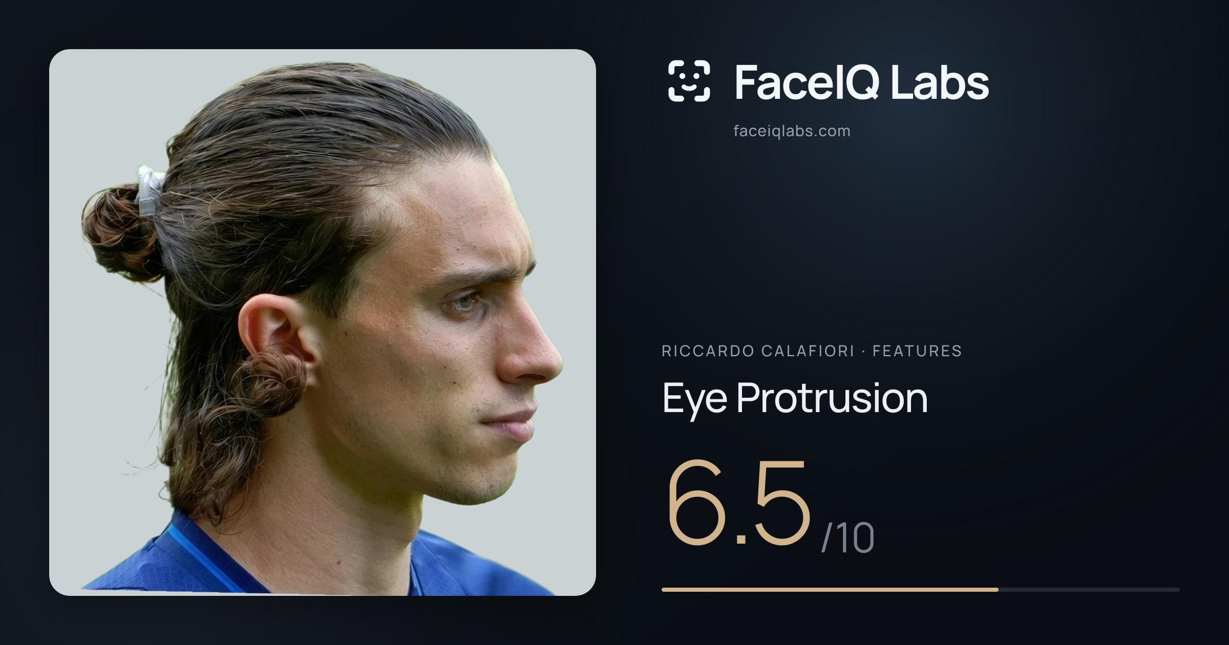 Riccardo Calafiori Eye Protrusion: 6.5/10, drawn on the photo