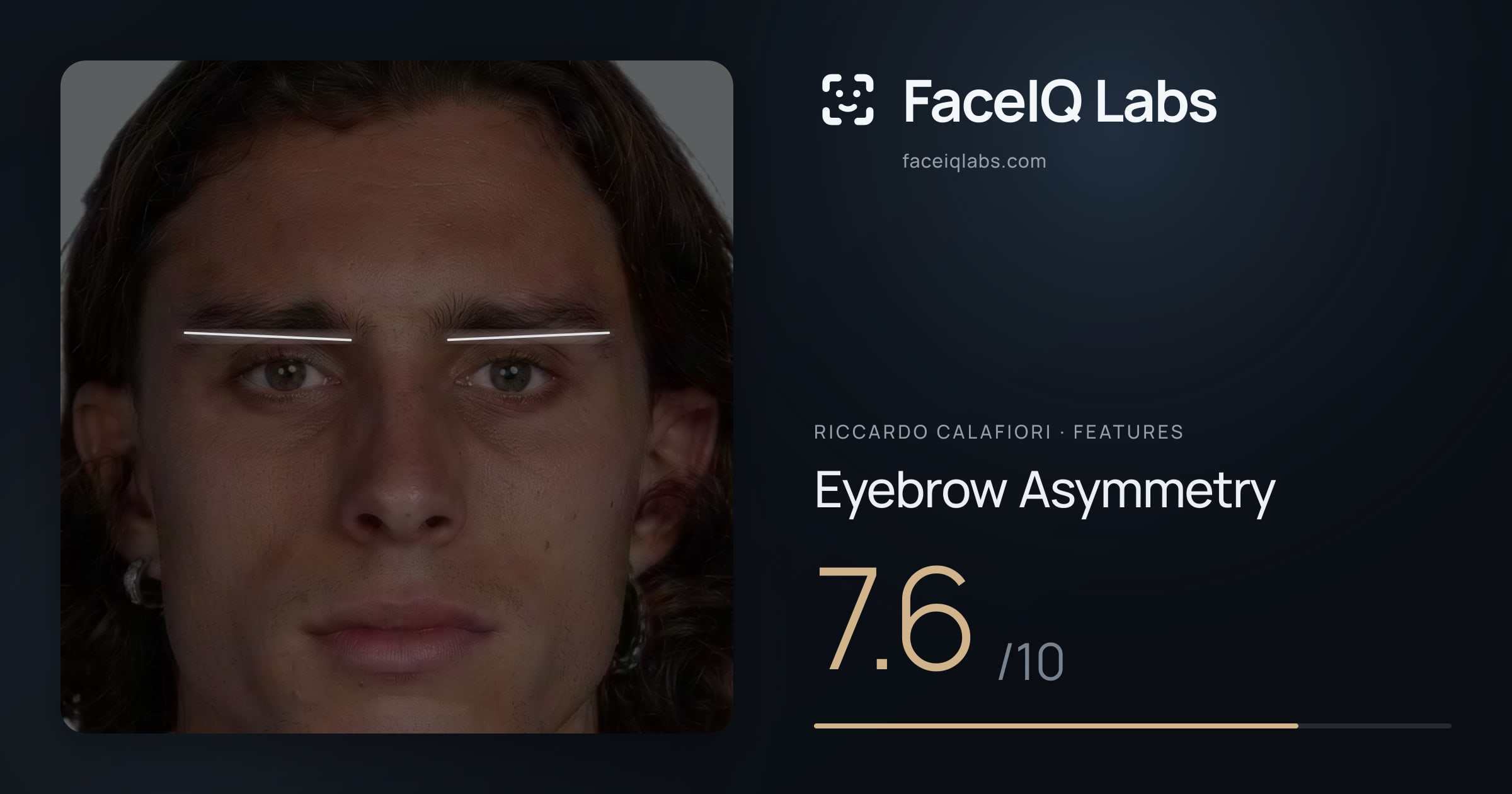 Riccardo Calafiori Eyebrow Asymmetry: 7.6/10, drawn on the photo