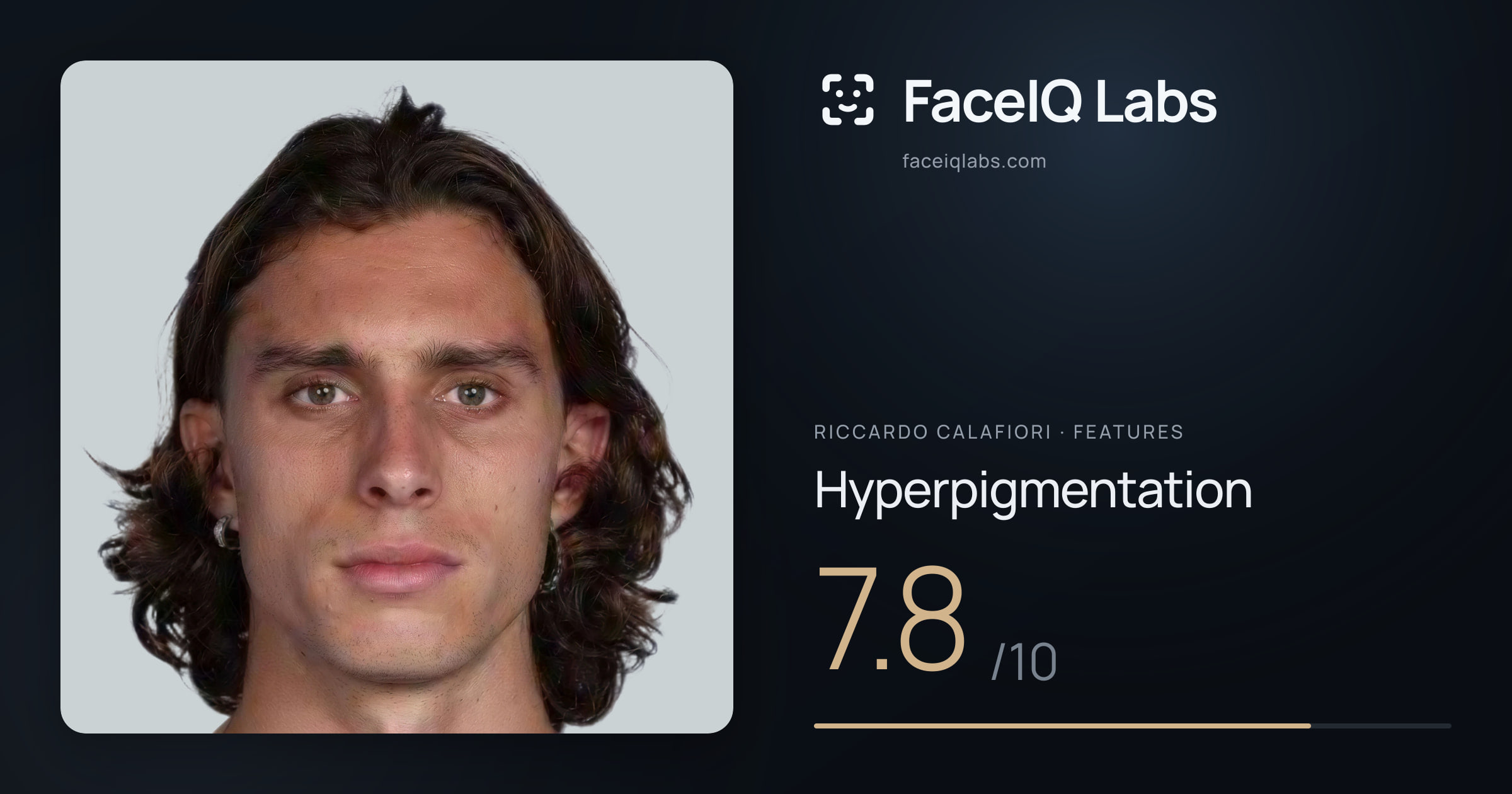 Riccardo Calafiori Hyperpigmentation: 7.8/10, drawn on the photo