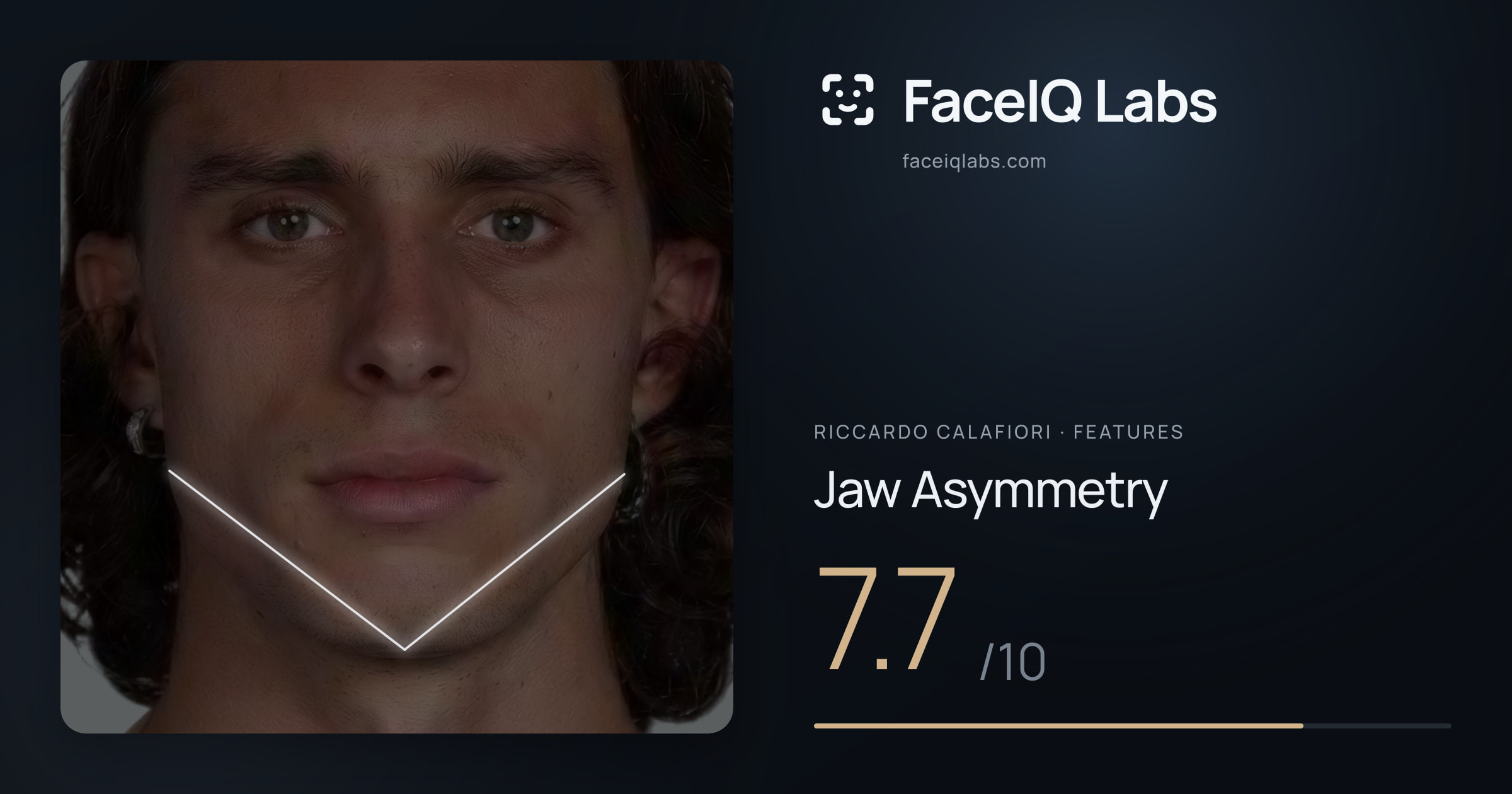 Riccardo Calafiori Jaw Asymmetry: 7.7/10, drawn on the photo