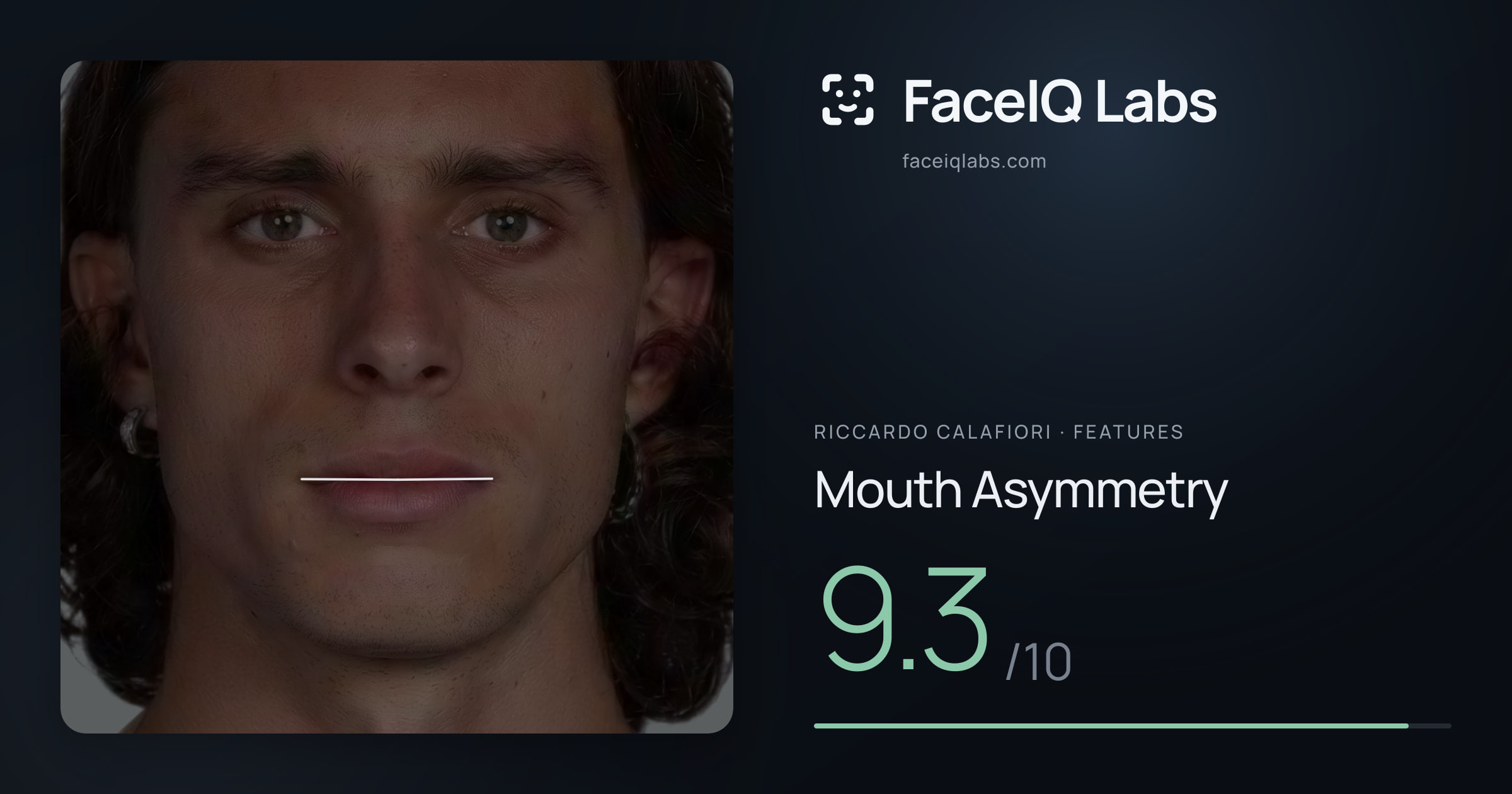 Riccardo Calafiori Mouth Asymmetry: 9.3/10, drawn on the photo