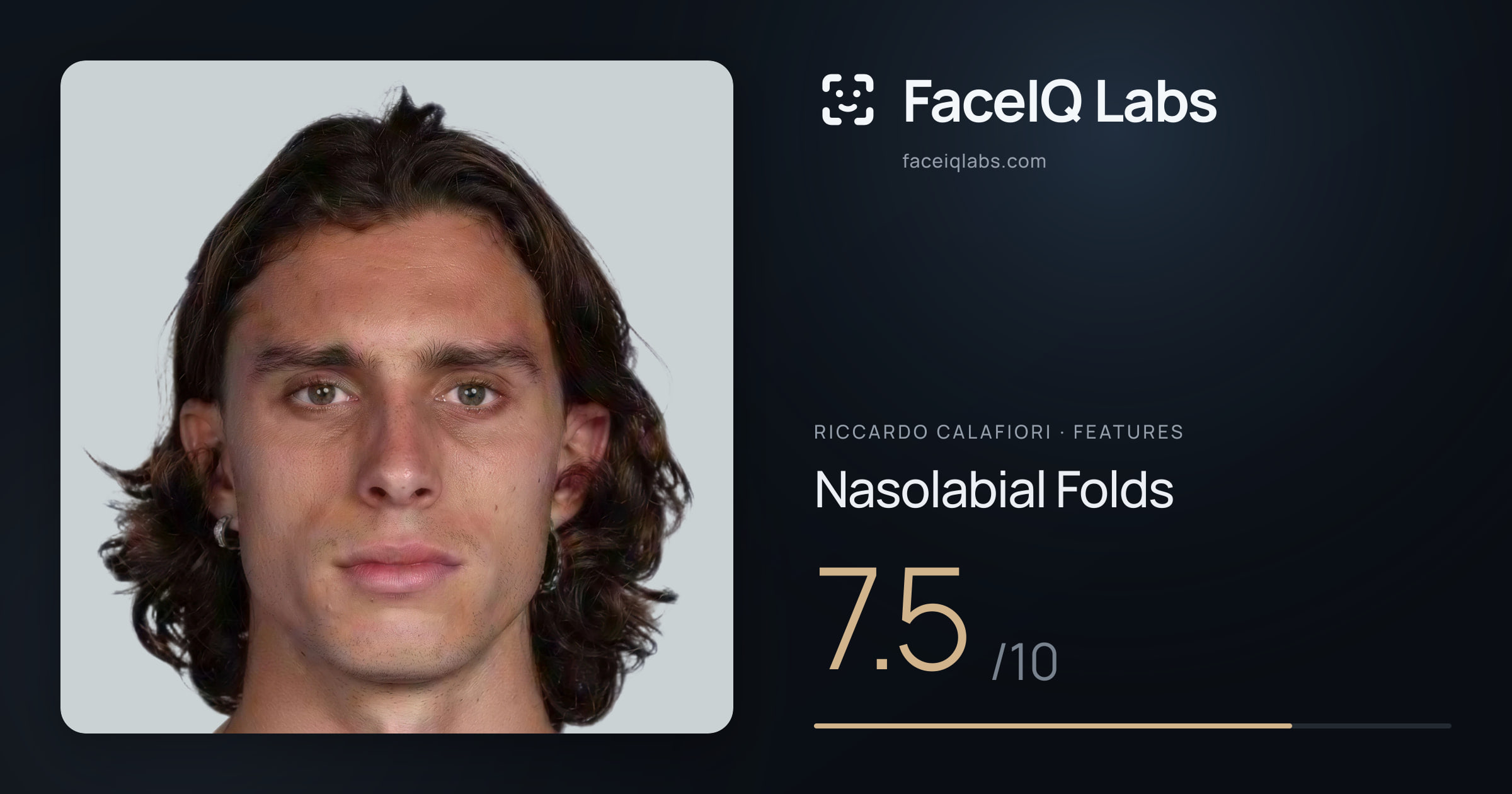 Riccardo Calafiori Nasolabial Folds: 7.5/10, drawn on the photo