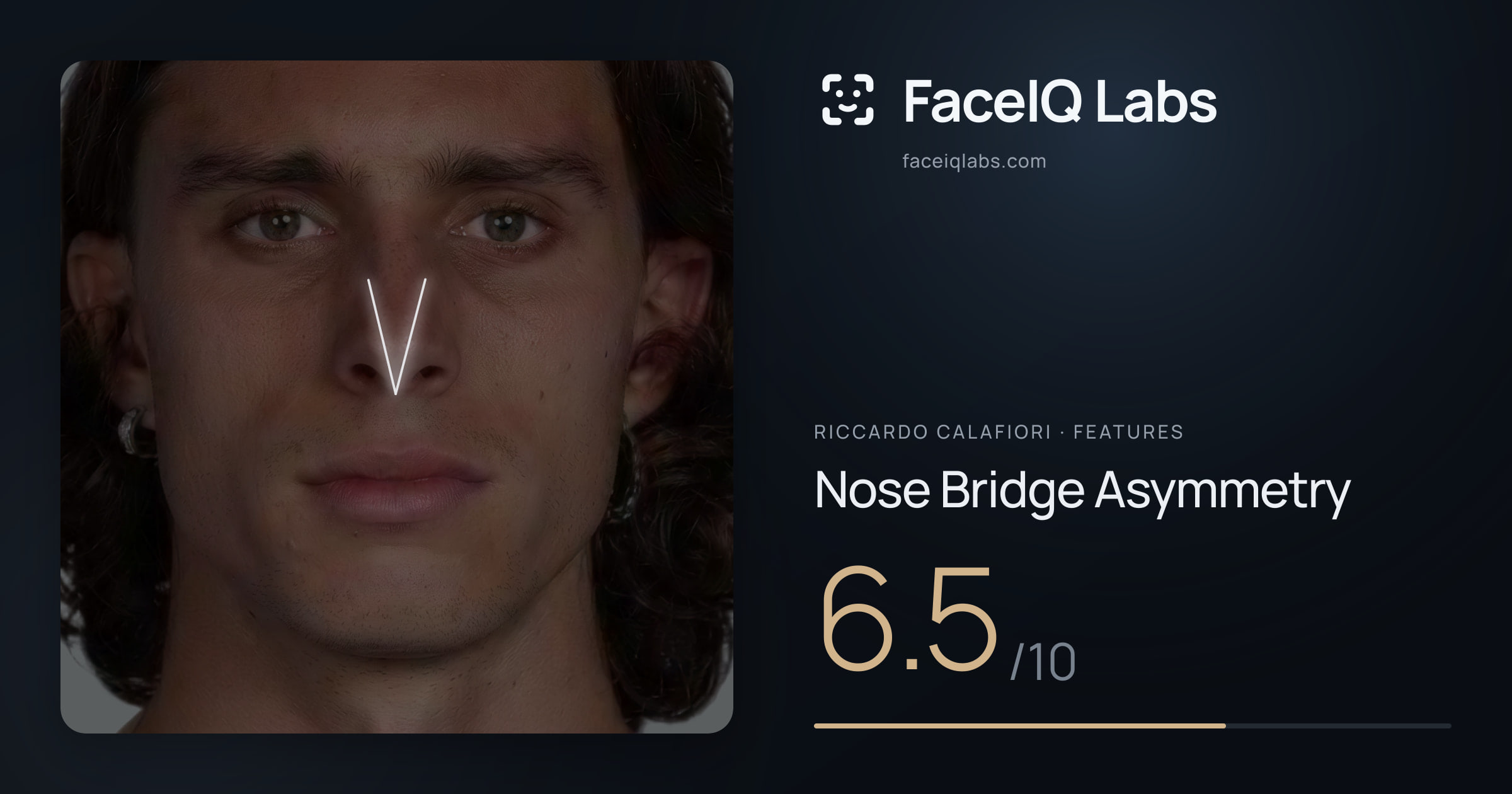 Riccardo Calafiori Nose Bridge Asymmetry: 6.5/10, drawn on the photo