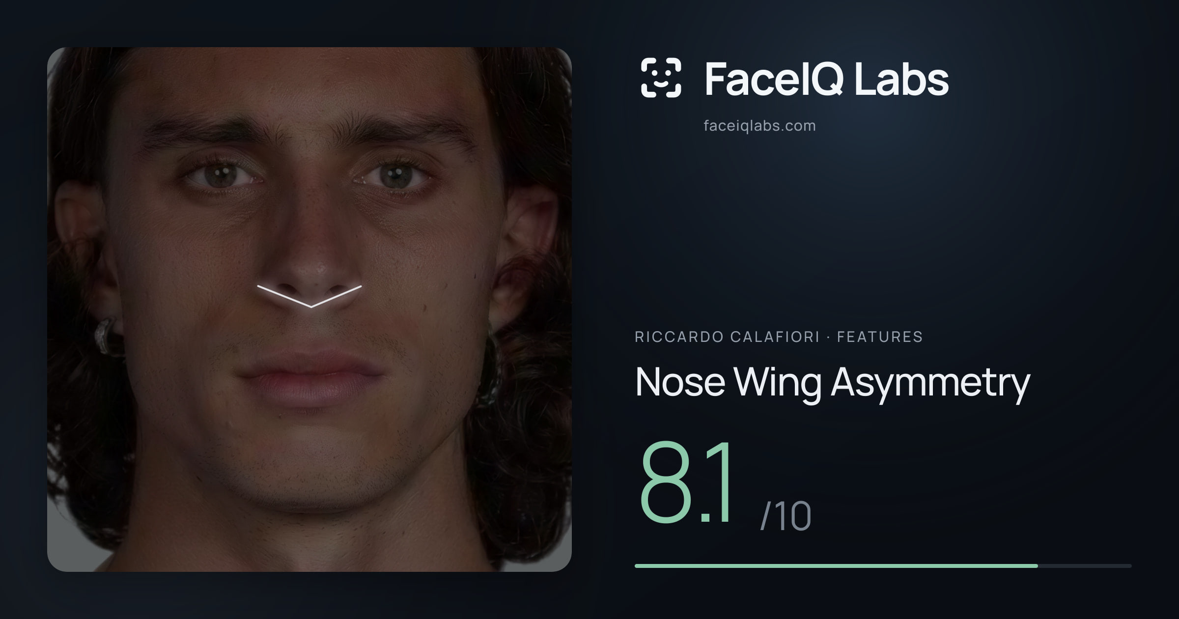 Riccardo Calafiori Nose Wing Asymmetry: 8.1/10, drawn on the photo