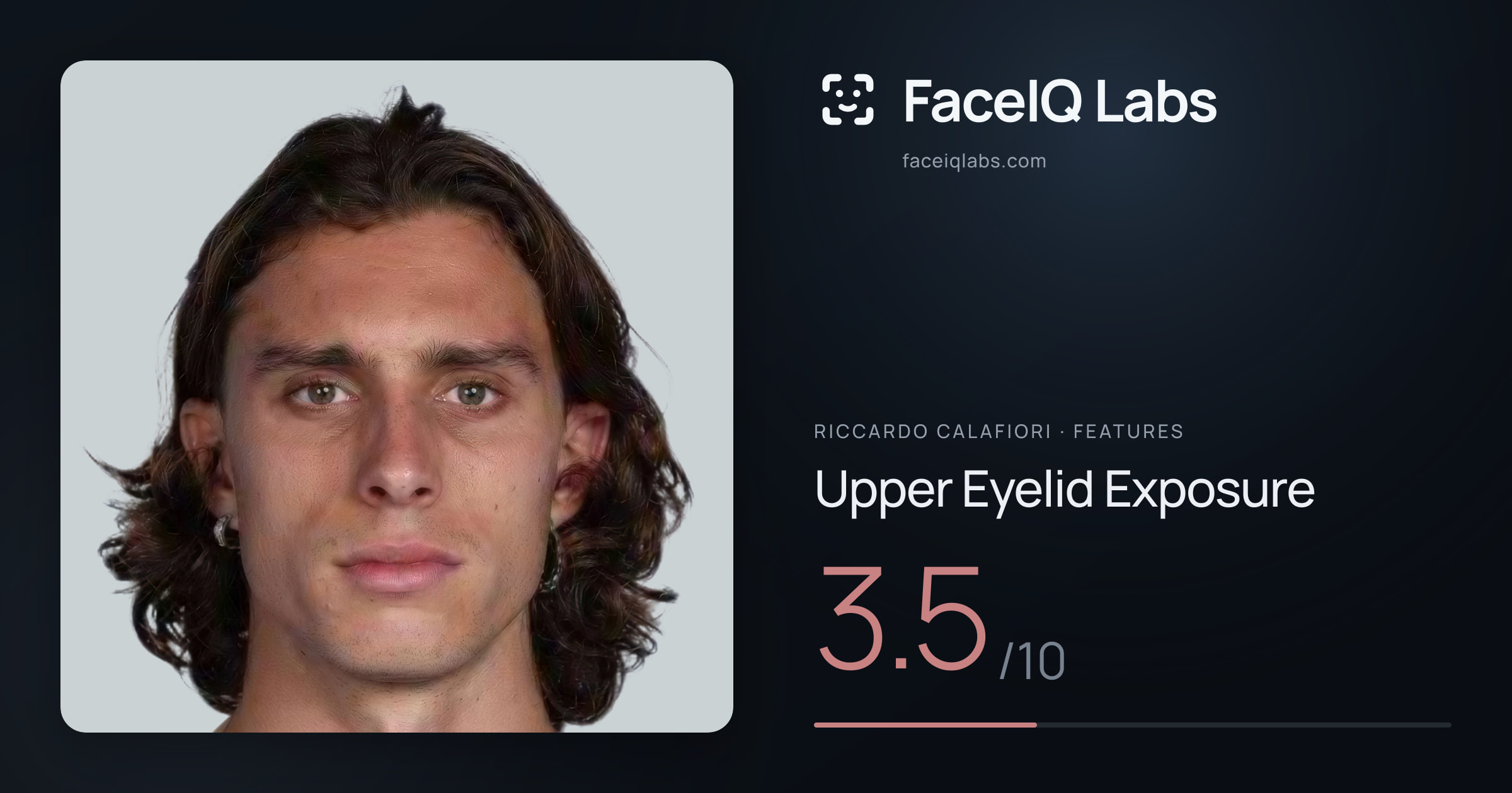 Riccardo Calafiori Upper Eyelid Exposure: 3.5/10, drawn on the photo