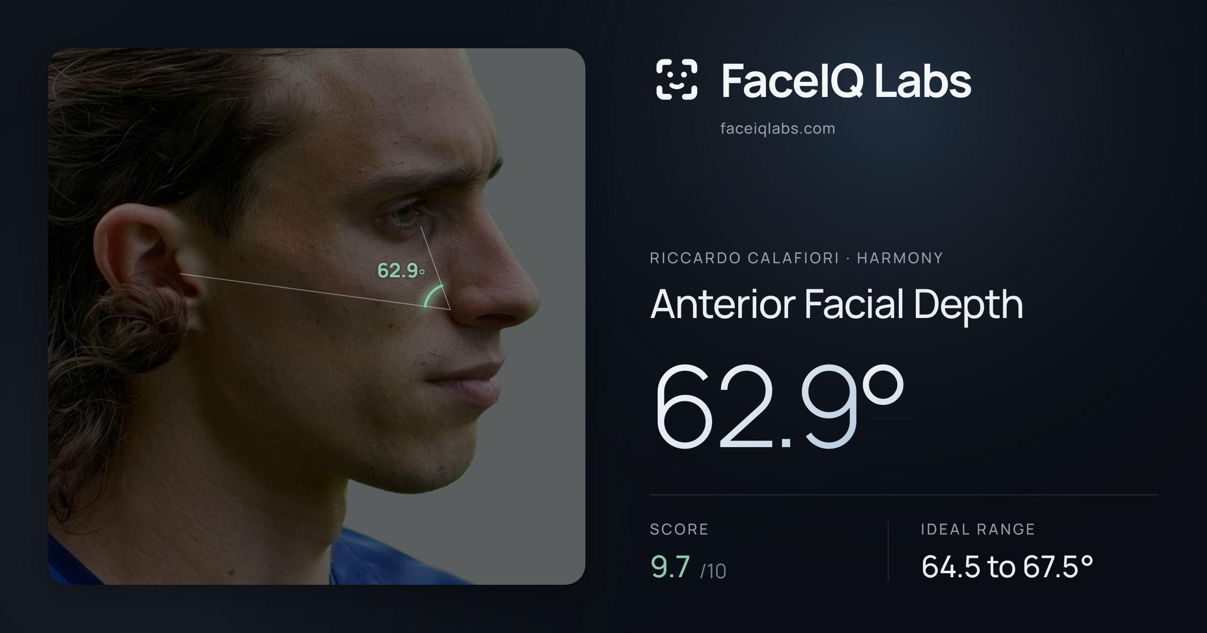 Riccardo Calafiori Anterior Facial Depth: 62.9°, drawn on the photo