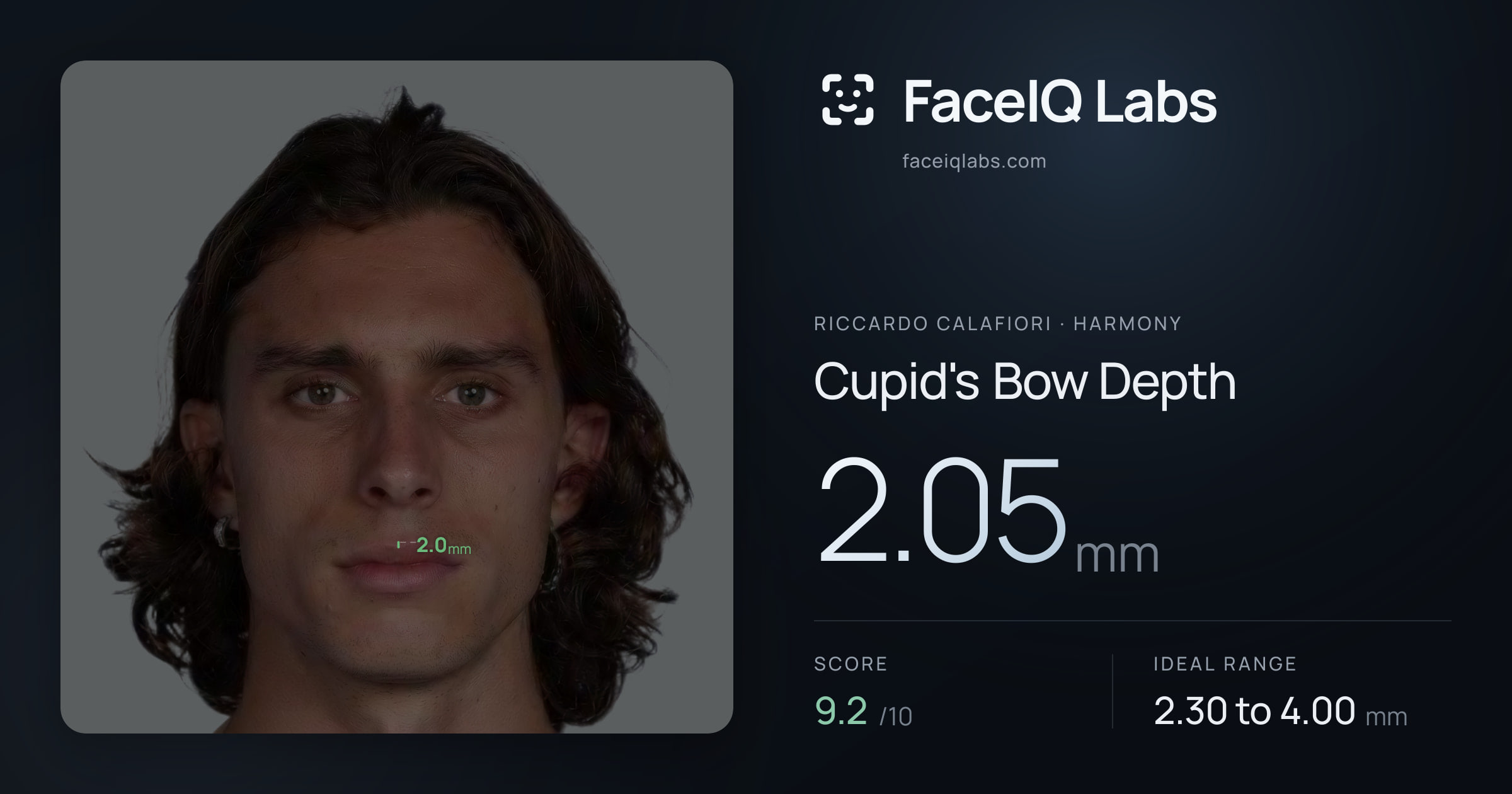 Riccardo Calafiori Cupid's Bow Depth: 2.05mm, drawn on the photo