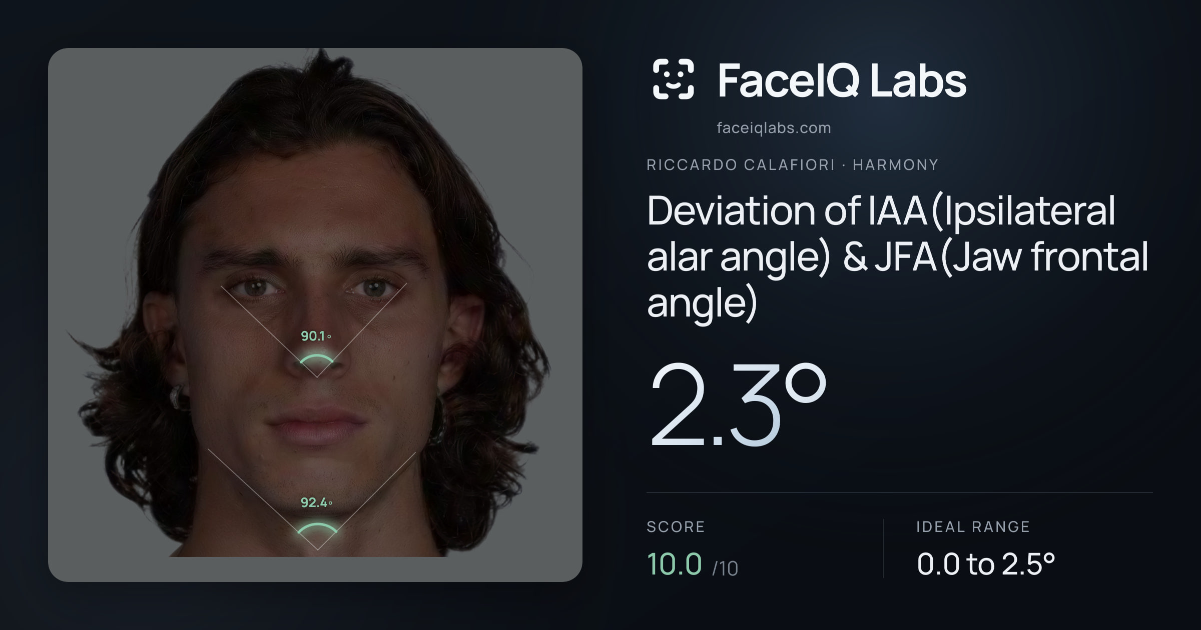 Riccardo Calafiori Deviation of IAA(Ipsilateral alar angle) & JFA(Jaw frontal angle): 2.3°, drawn on the photo