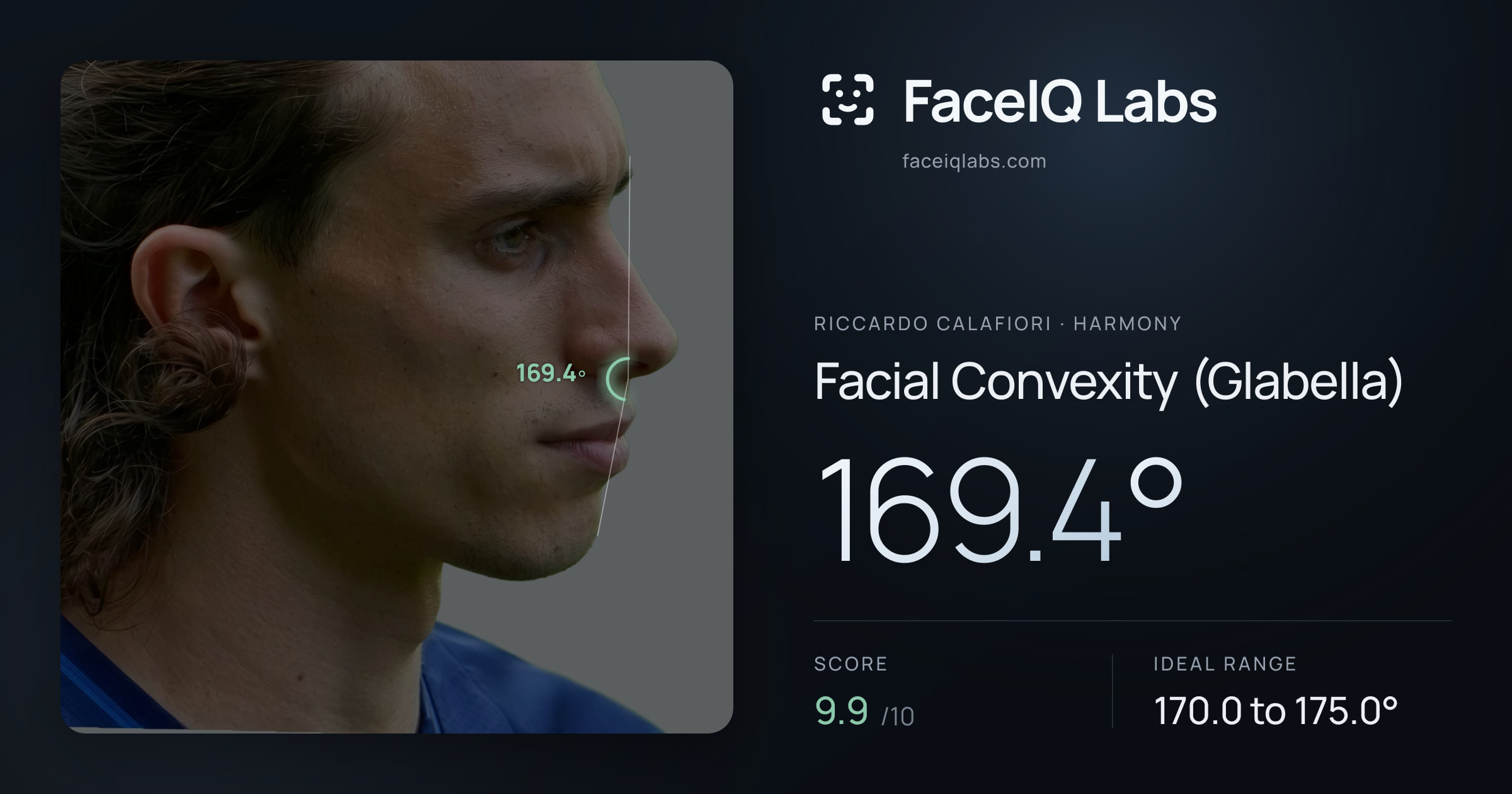 Riccardo Calafiori Facial Convexity (Glabella): 169.4°, drawn on the photo