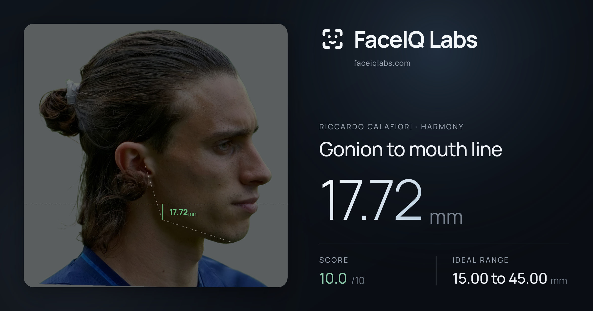 Riccardo Calafiori Gonion to mouth line: 17.72mm, drawn on the photo