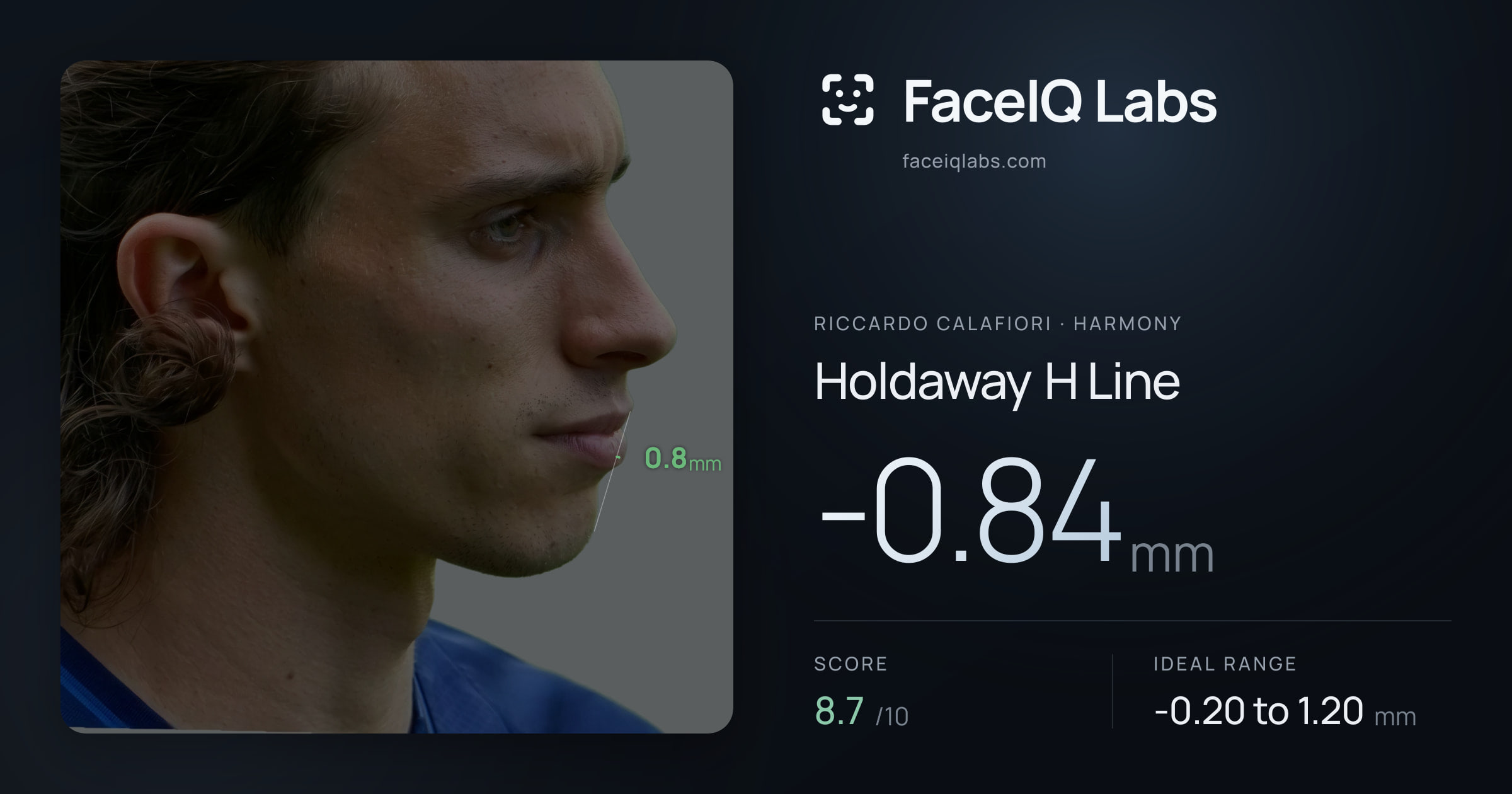 Riccardo Calafiori Holdaway H Line: -0.84mm, drawn on the photo