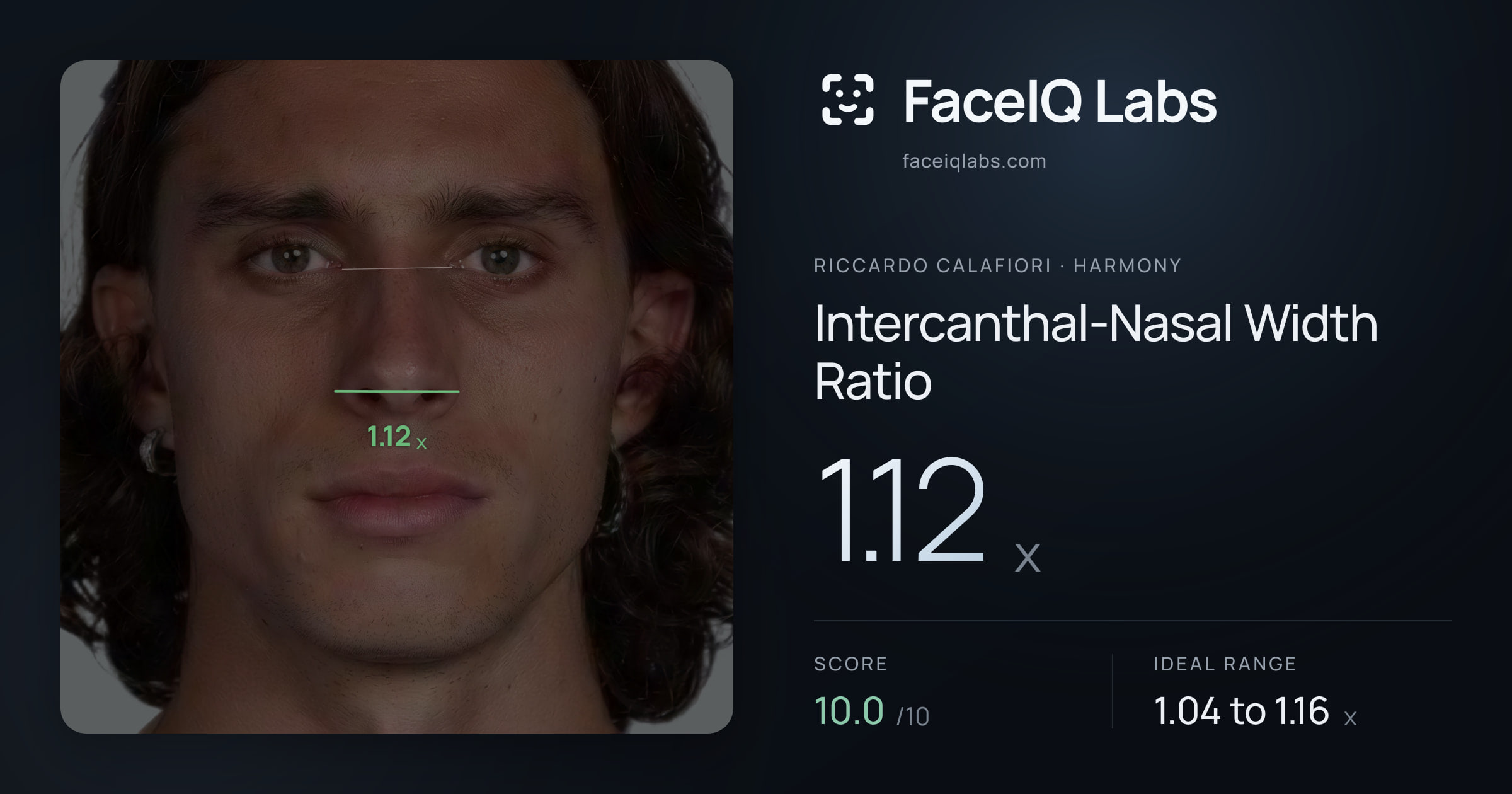 Riccardo Calafiori Intercanthal-Nasal Width Ratio: 1.12x, drawn on the photo