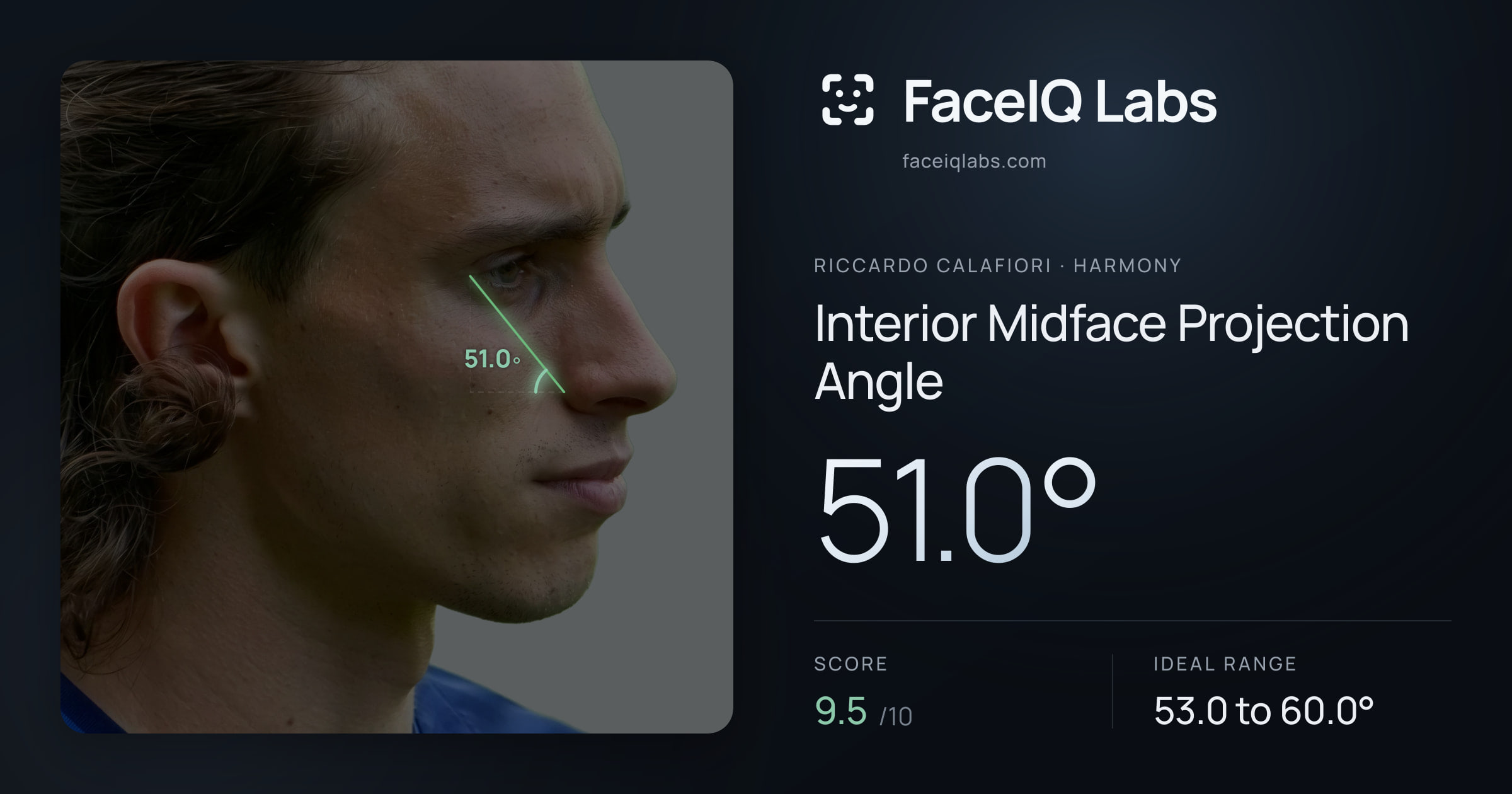 Riccardo Calafiori Interior Midface Projection Angle: 51.0°, drawn on the photo