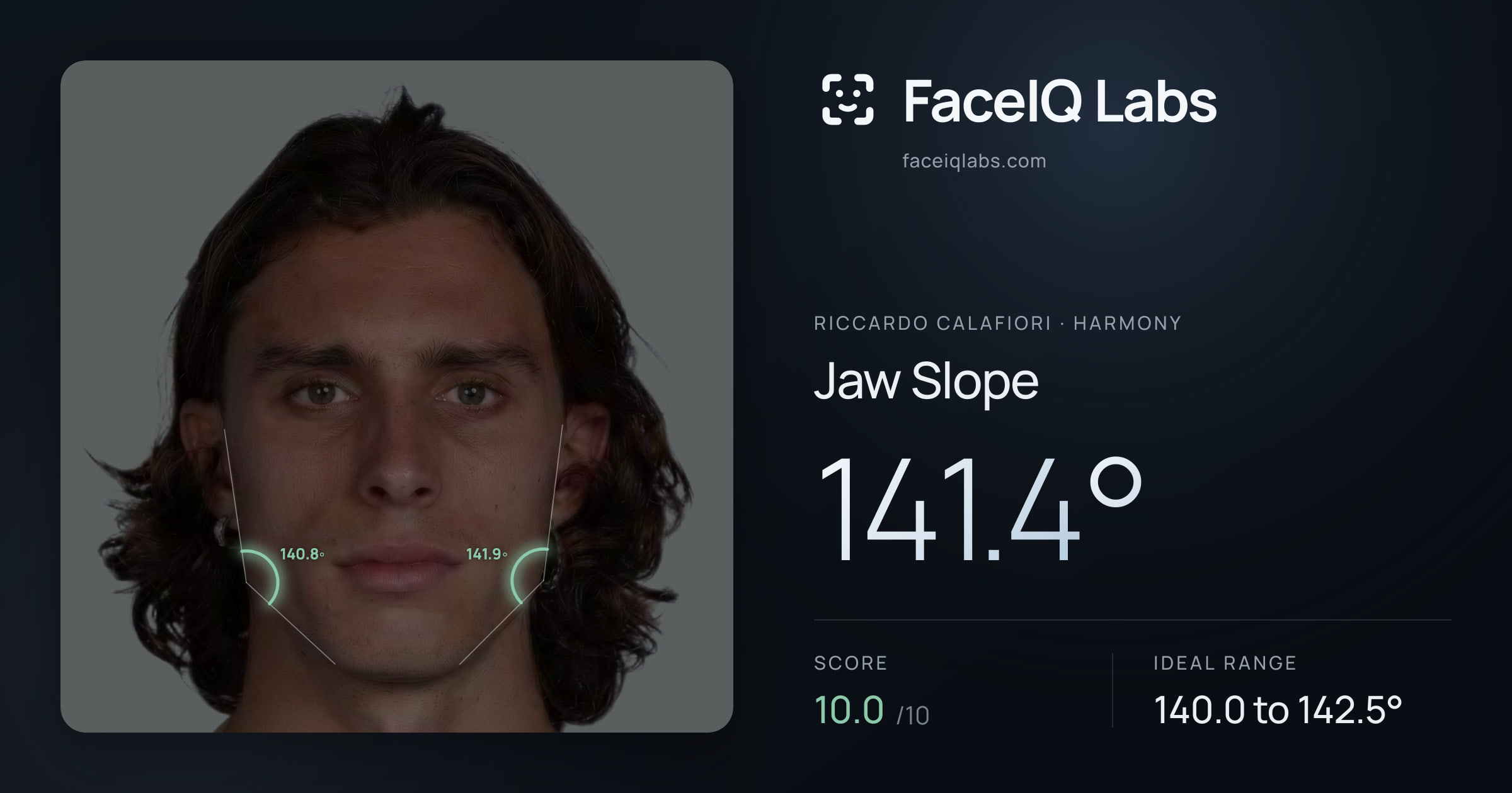 Riccardo Calafiori Jaw Slope: 141.4°, drawn on the photo