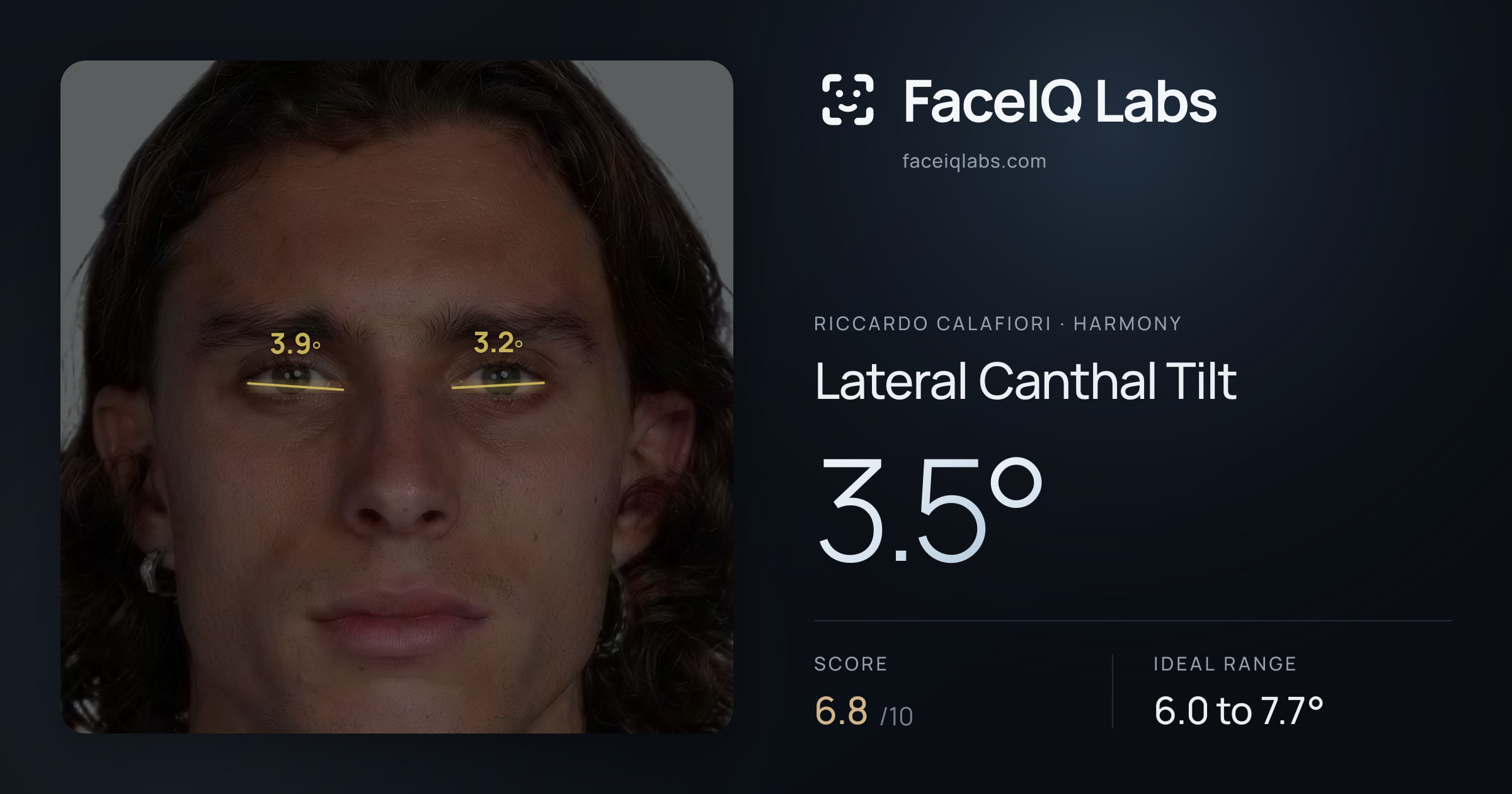 Riccardo Calafiori Lateral Canthal Tilt: 3.5°, drawn on the photo