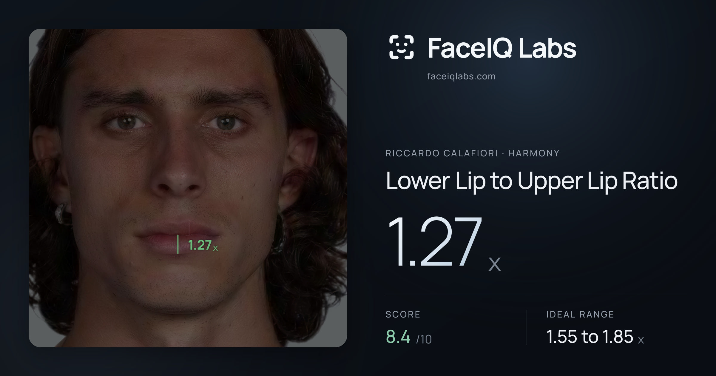 Riccardo Calafiori Lower Lip to Upper Lip Ratio: 1.27x, drawn on the photo