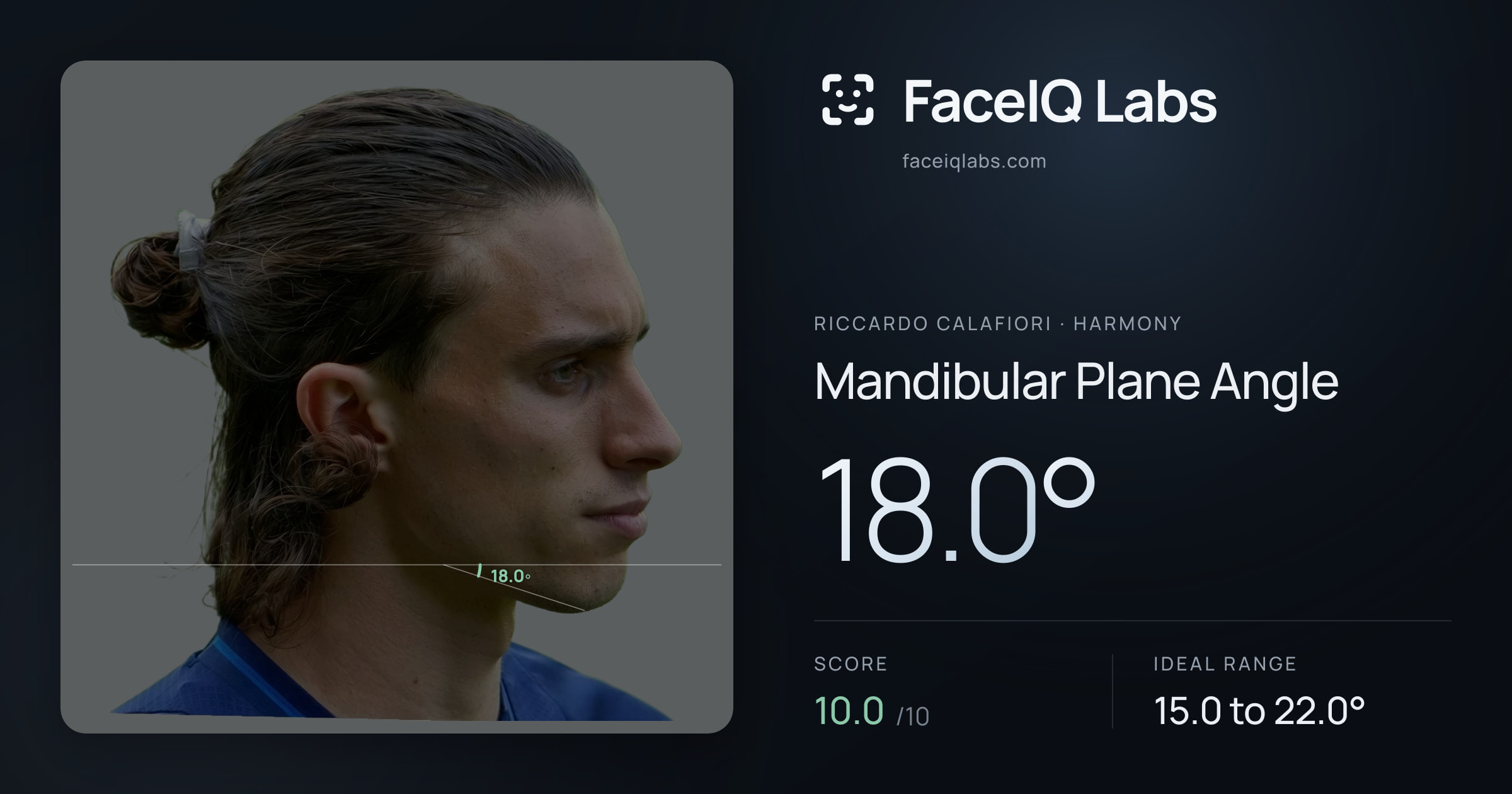 Riccardo Calafiori Mandibular Plane Angle: 18.0°, drawn on the photo