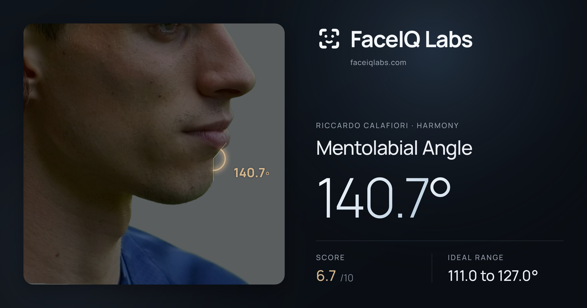 Riccardo Calafiori Mentolabial Angle: 140.7°, drawn on the photo