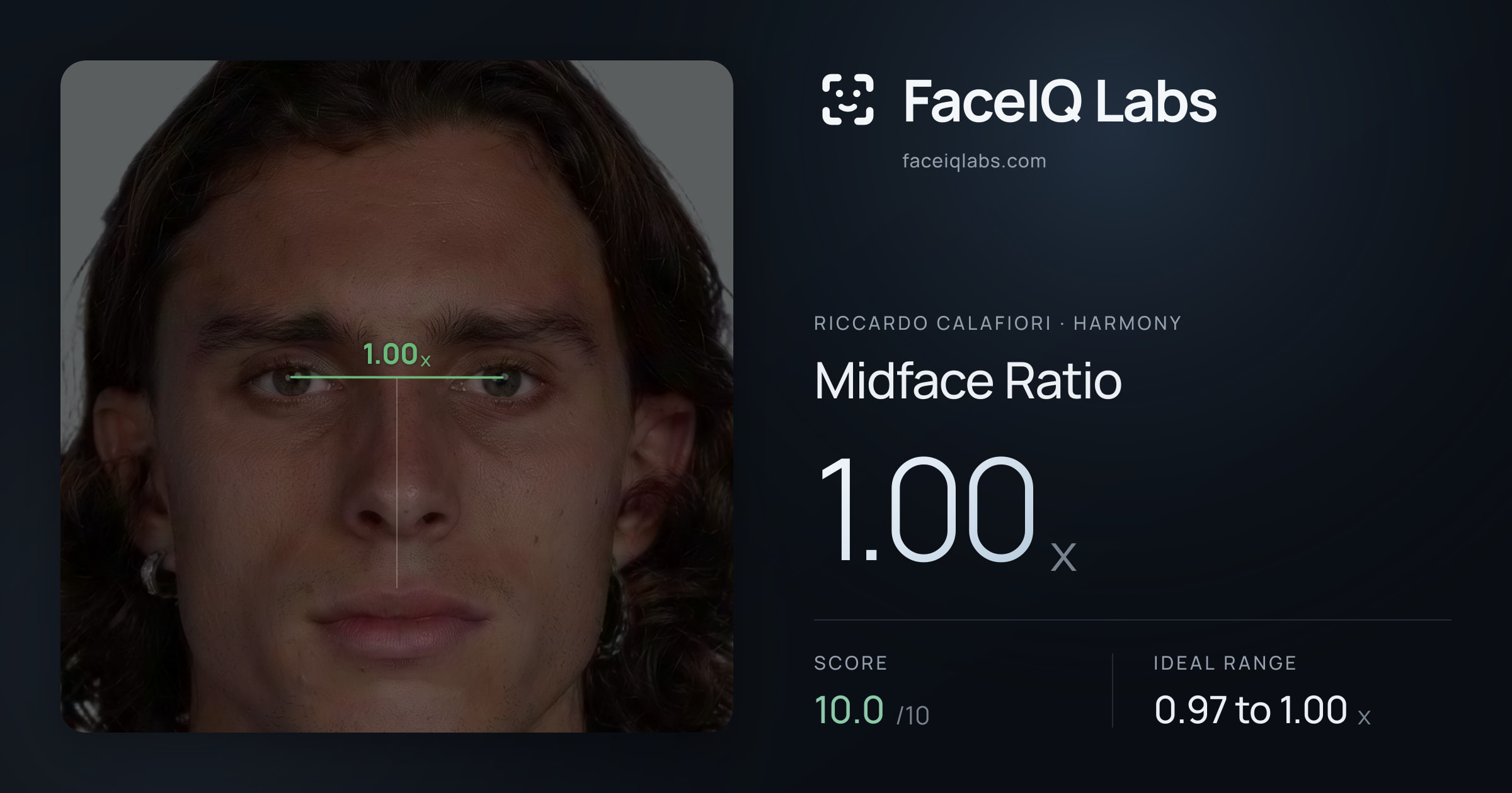 Riccardo Calafiori Midface Ratio: 1.00x, drawn on the photo