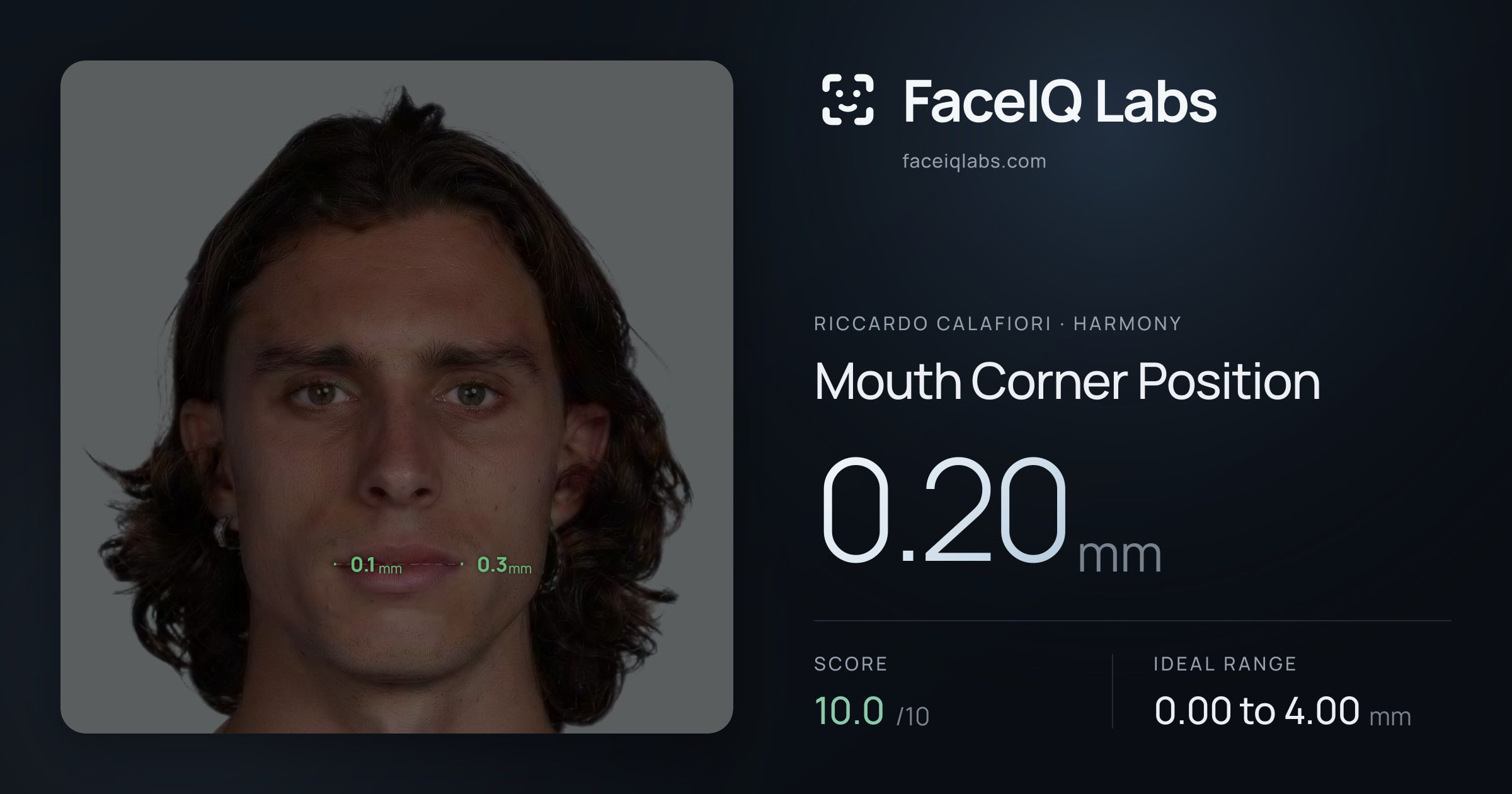 Riccardo Calafiori Mouth Corner Position: 0.20mm, drawn on the photo