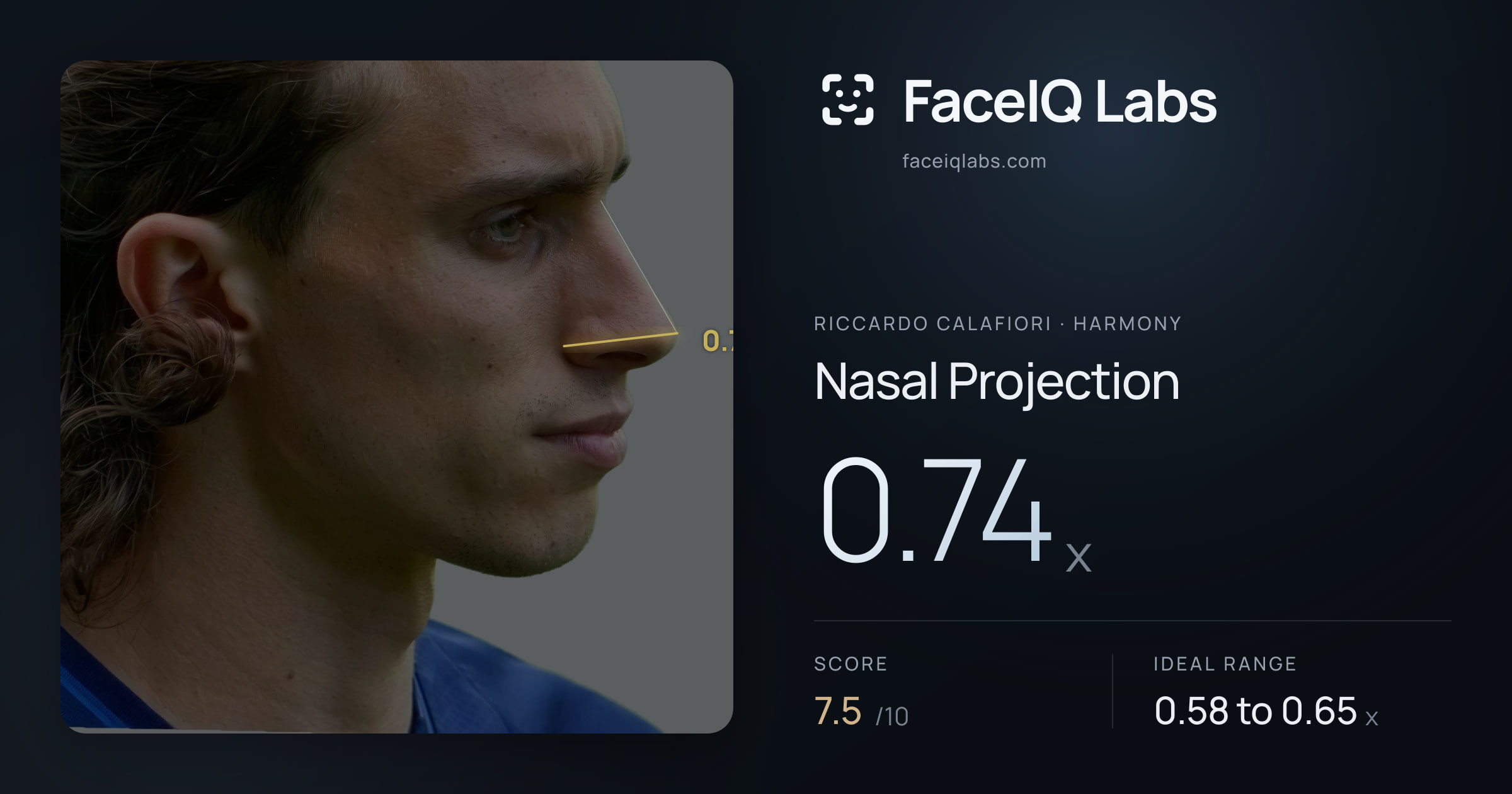 Riccardo Calafiori Nasal Projection: 0.74x, drawn on the photo